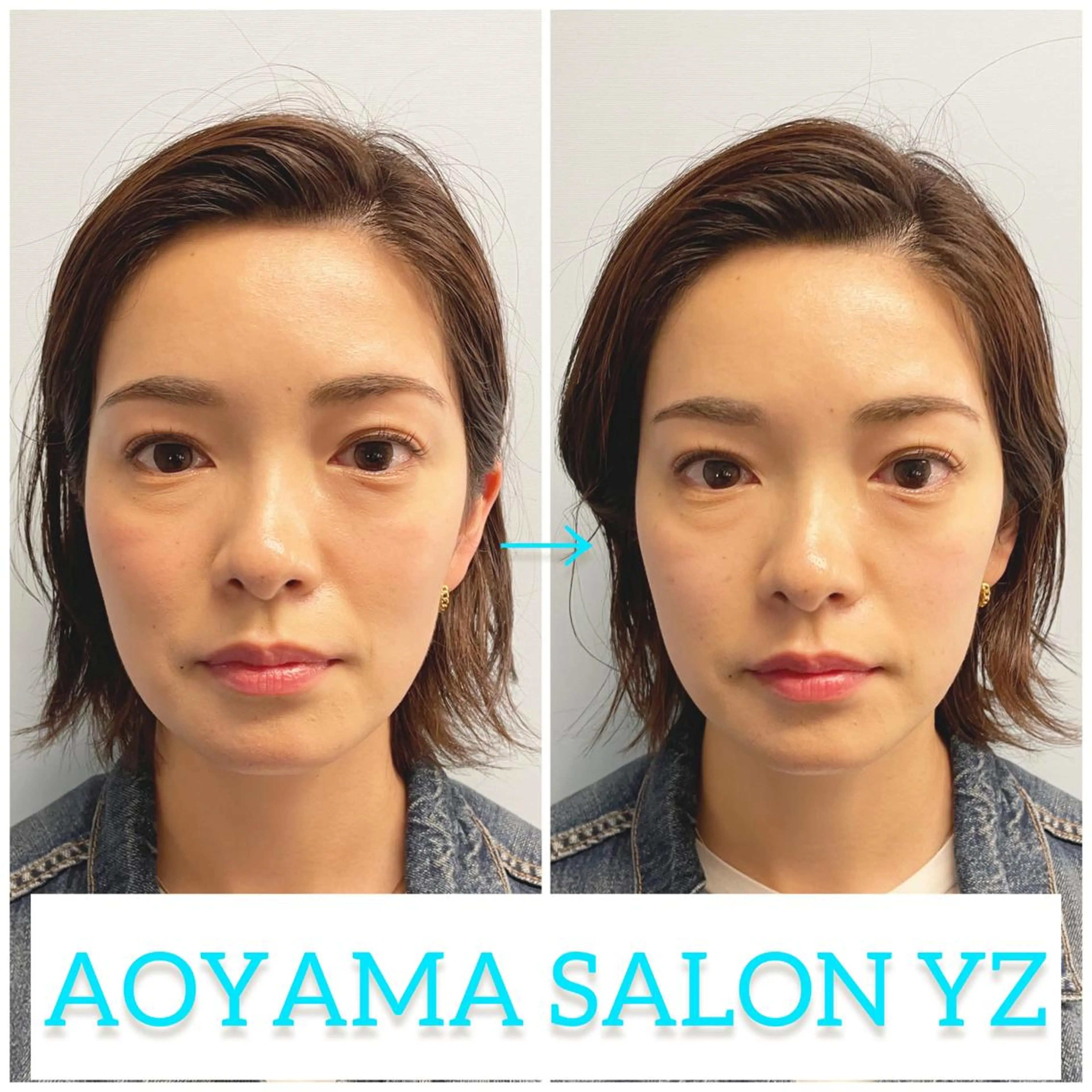 エステ リラク 小顔美容鍼専門サロン 渋谷YZのエステ・リラクイメージ