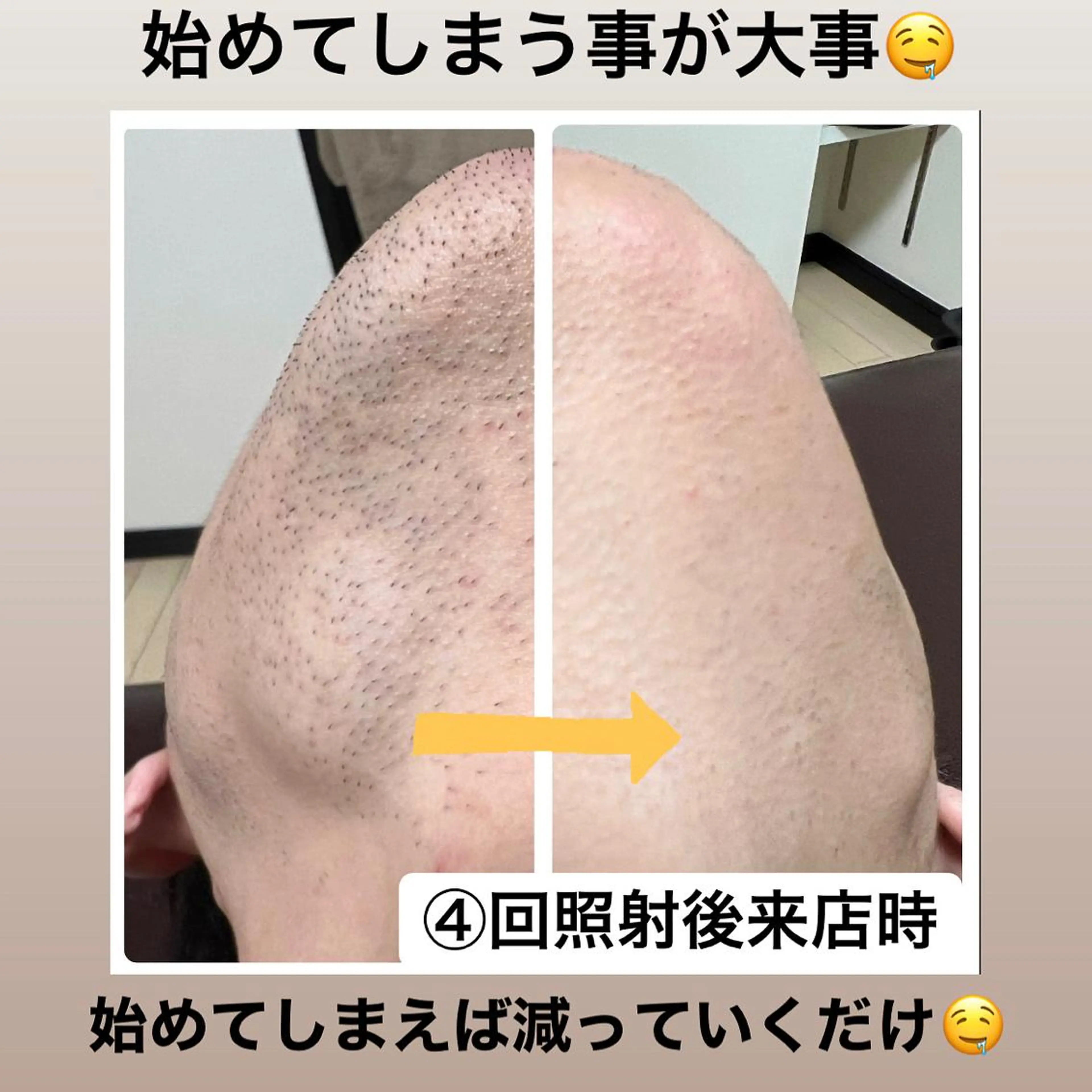 メンズ メンズハイライト メンズ脱毛サロン Le falcoのエステ・リラクイメージ