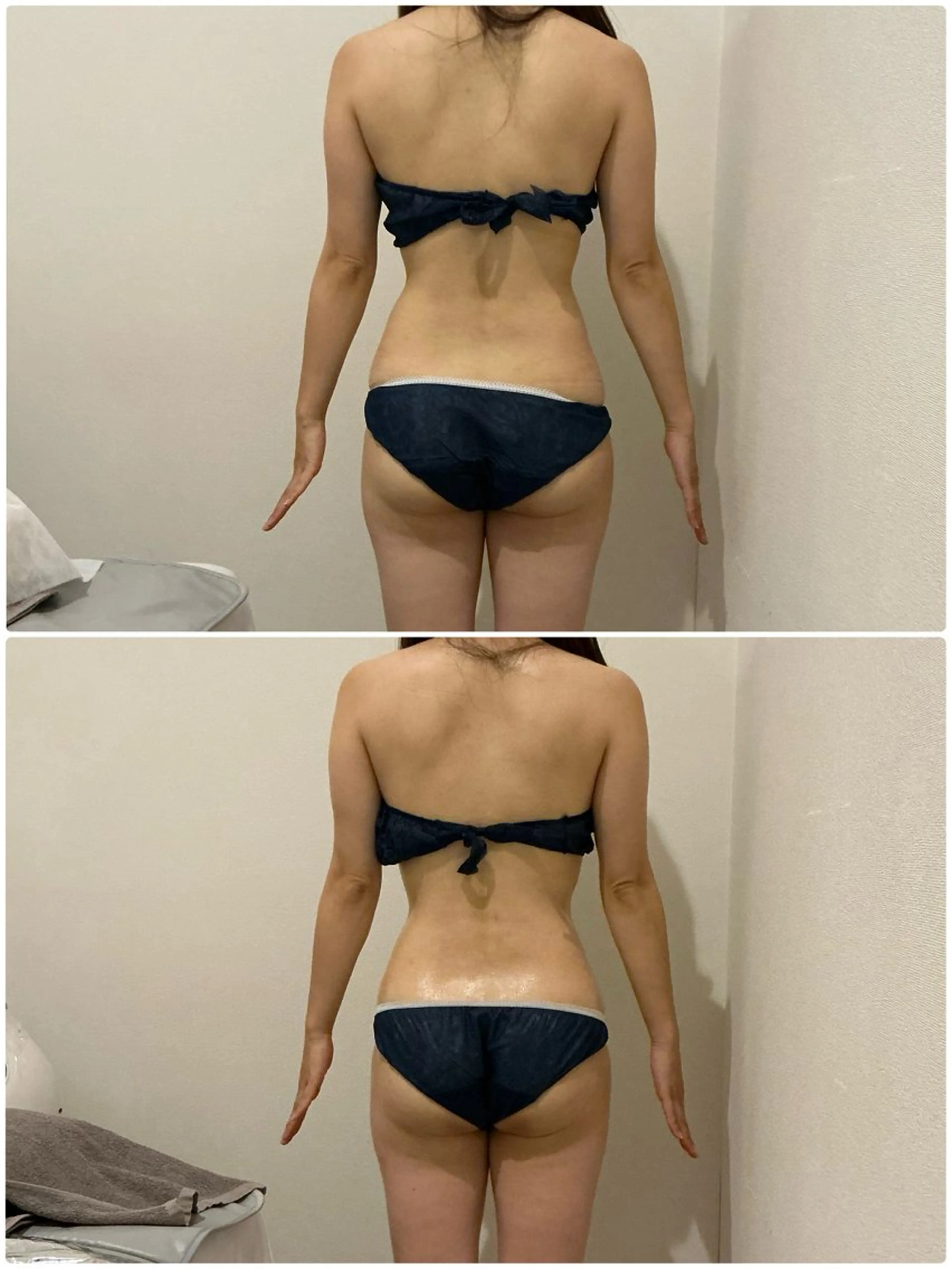 12月限定🎄【下半身】脂肪の原因になるセルライトケア👊💥デトックスマシン デトックストリートメント60分コース🍀の写真