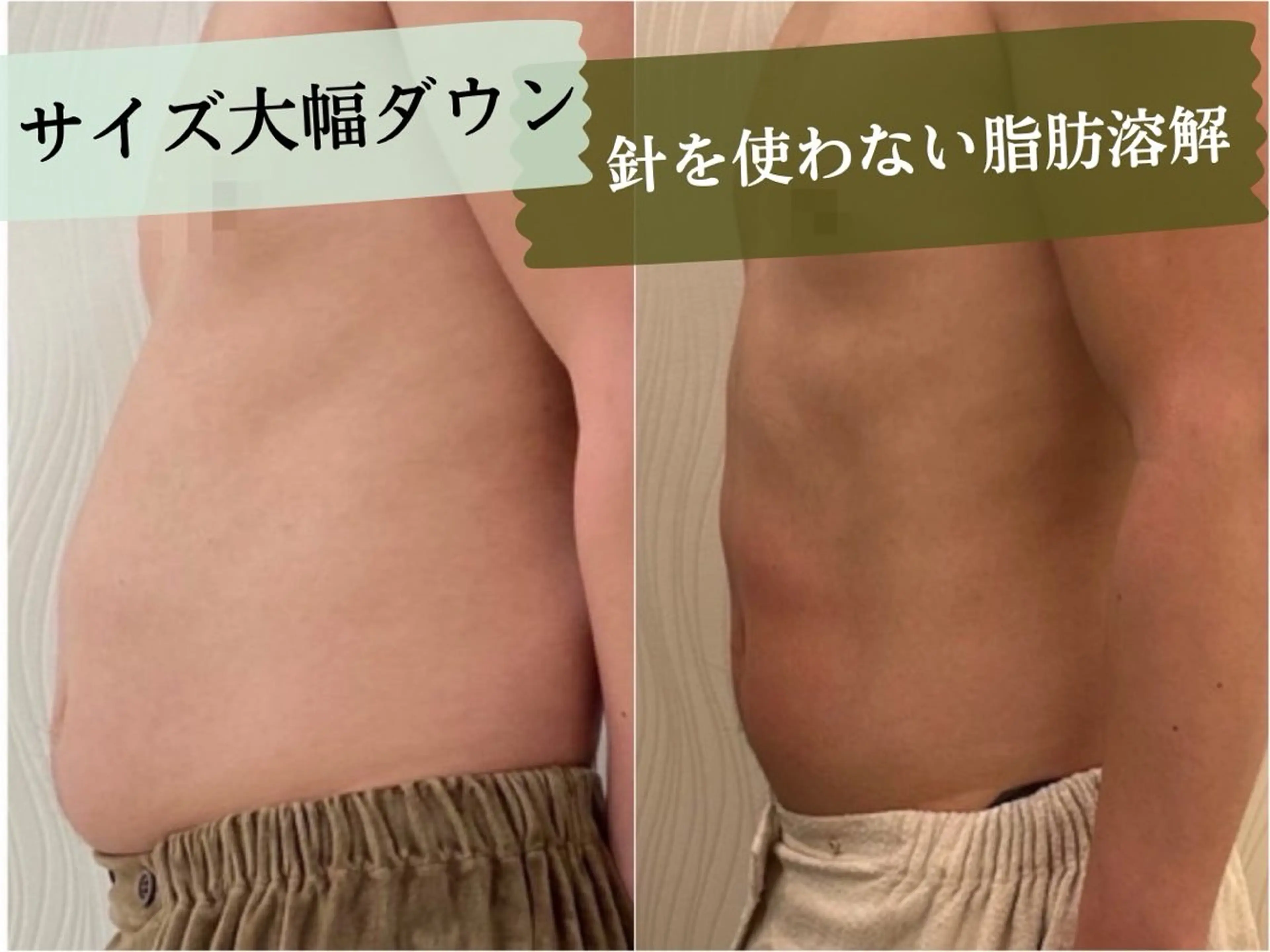 🌿2回目/3回目の方限定🌿針を使わない脂肪撃退【お身体1部位】の写真