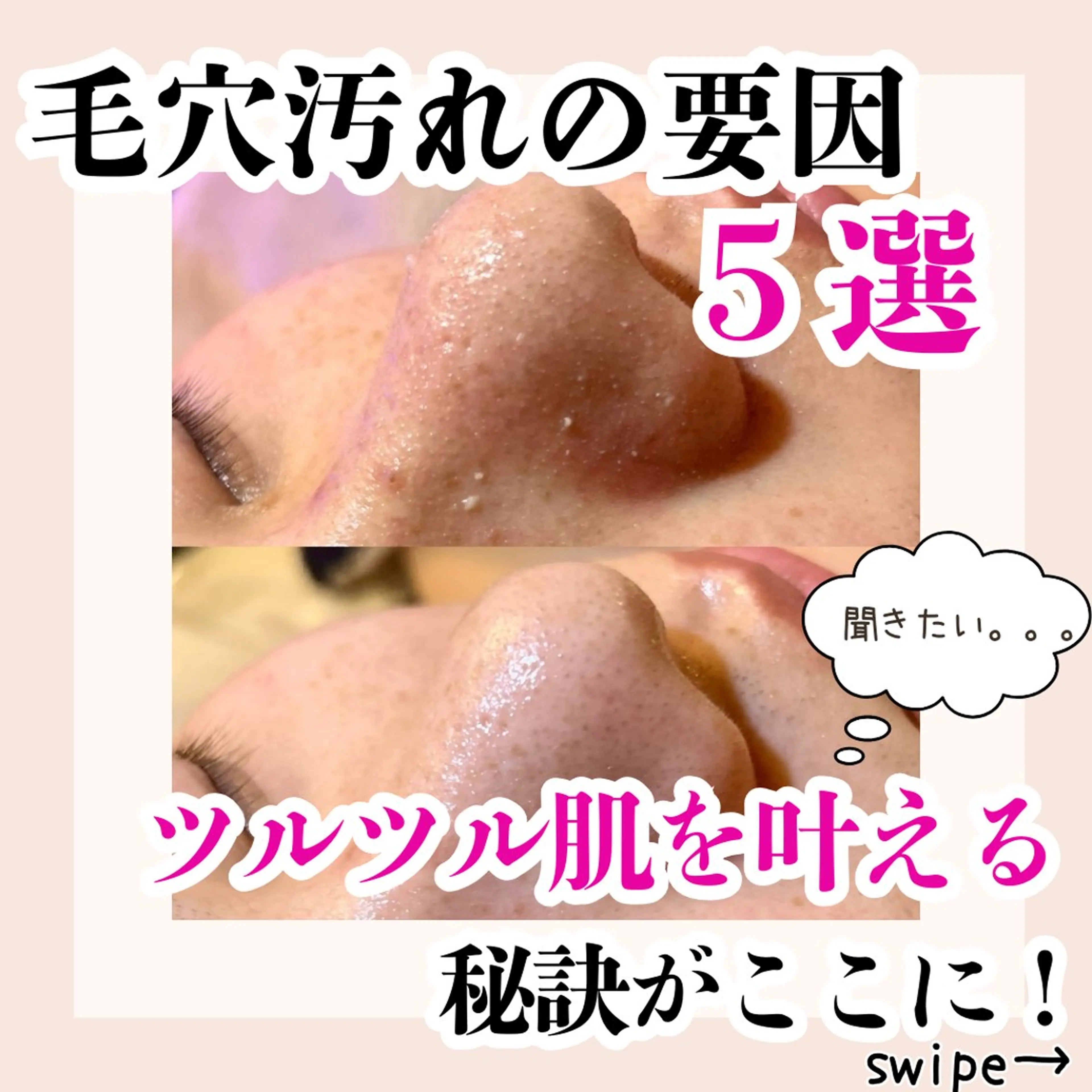 毛穴洗浄専門サロン/CareNa梅田【毛穴/ケアナ】所属・CareNa梅田店 🌿住田摩利弥のエステ・リラクイメージ