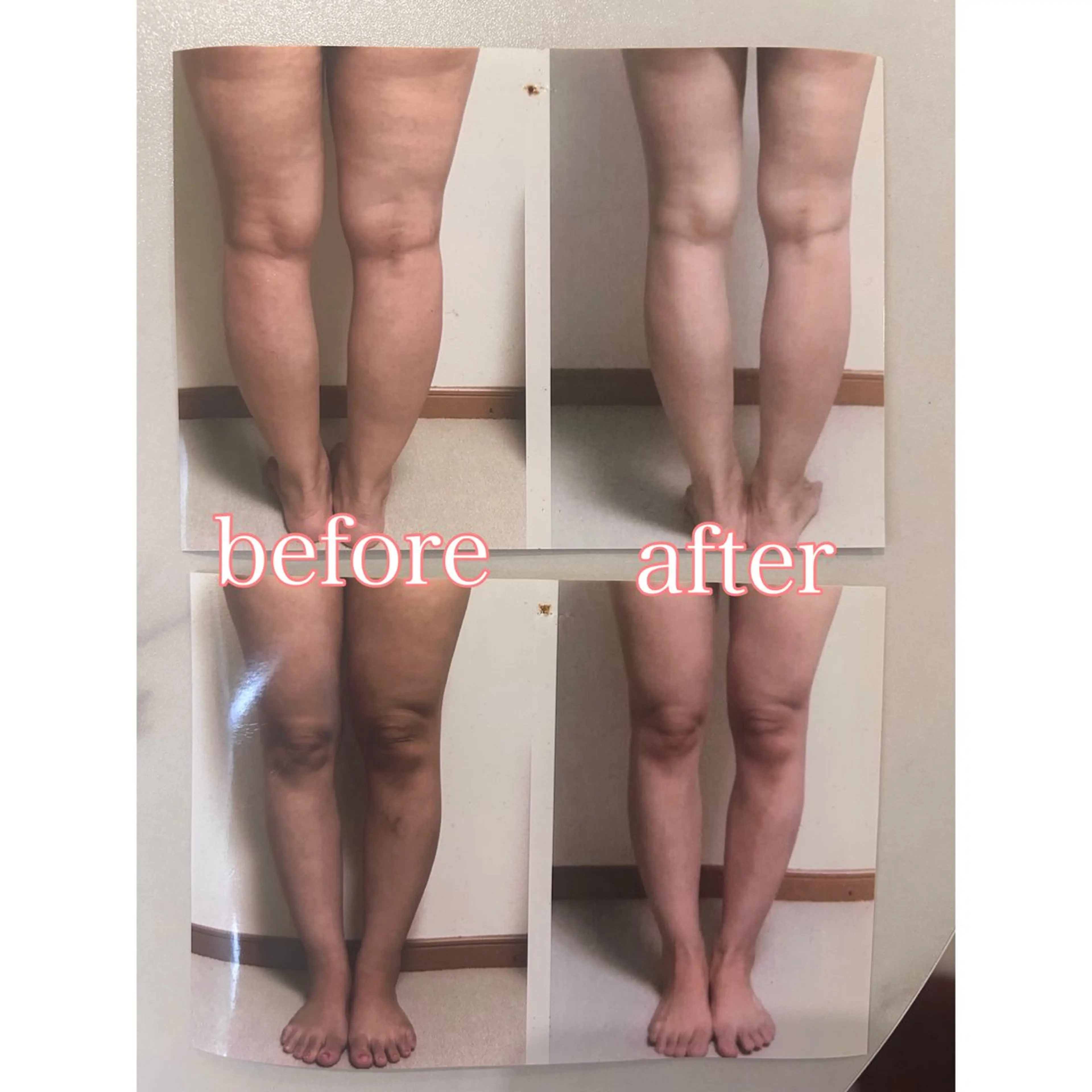 【お試しキャンペーン】完全オーダーメイド！今だけ！全身当て放題★最強のボディメイクマシンの写真