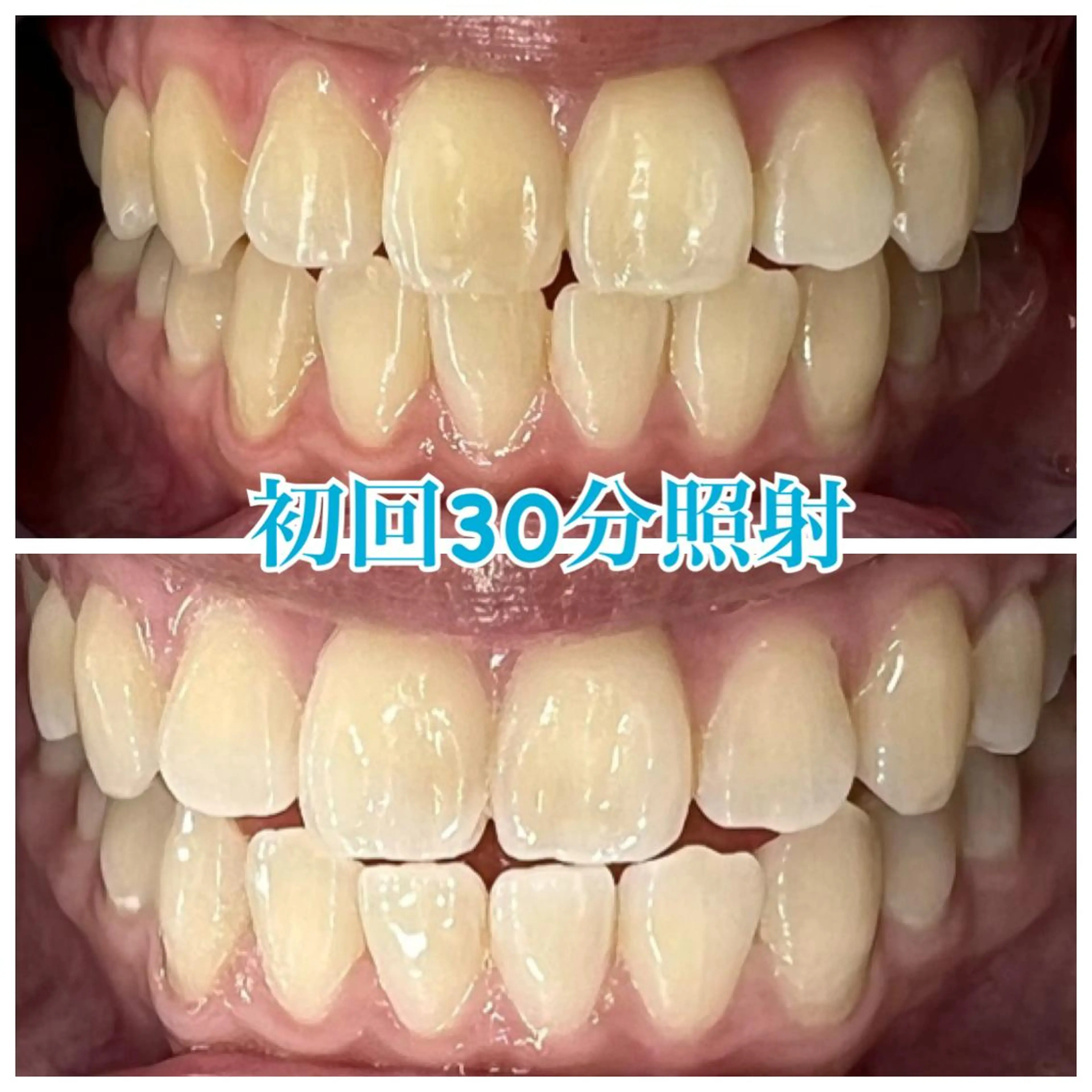 nailsalon   LE'A所属・ホワイトニング🦷 ネイル💅LEAのその他イメージ