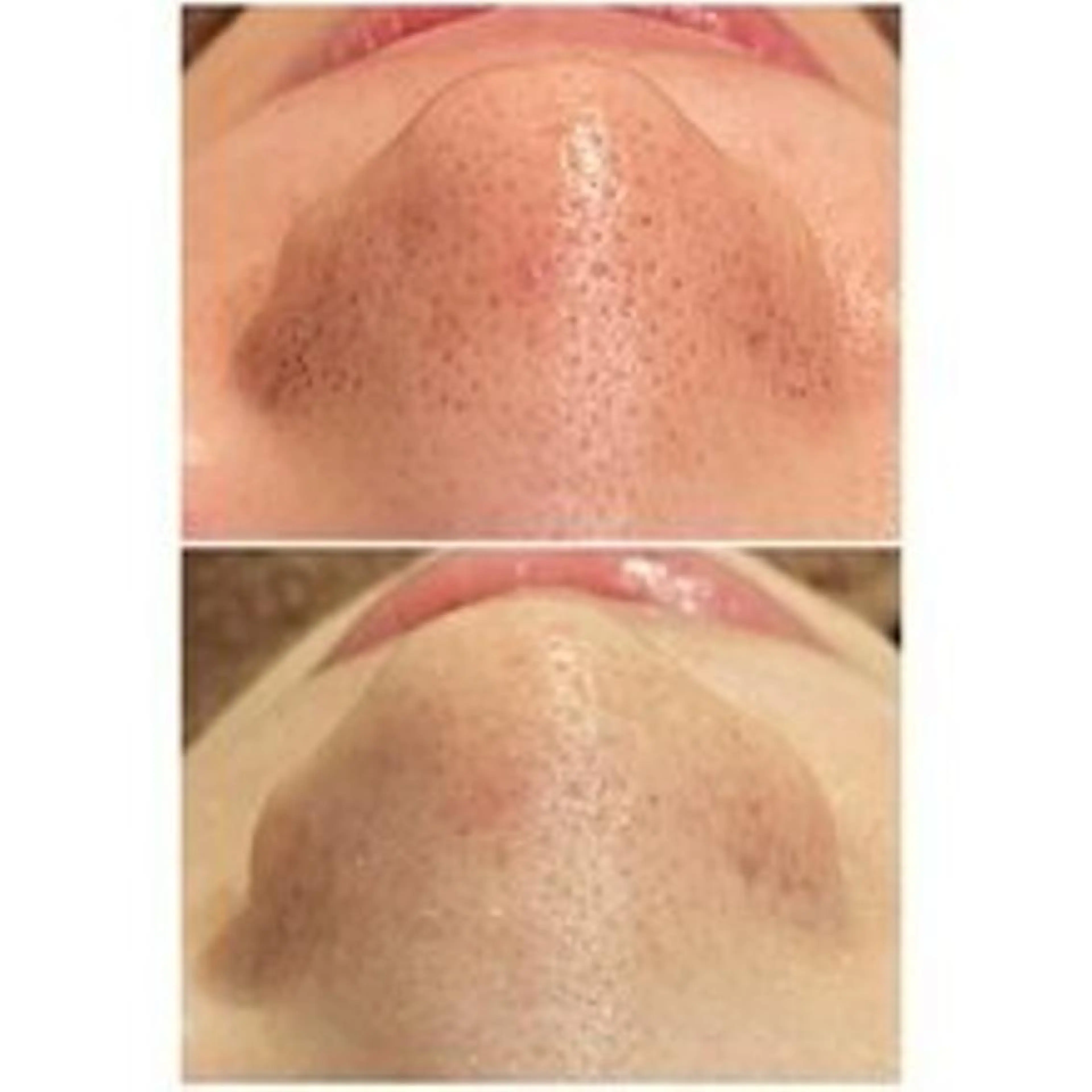 エステ リラク ニキビ・肌質改善専門 ♡人生が変わるサロンのエステ・リラクイメージ