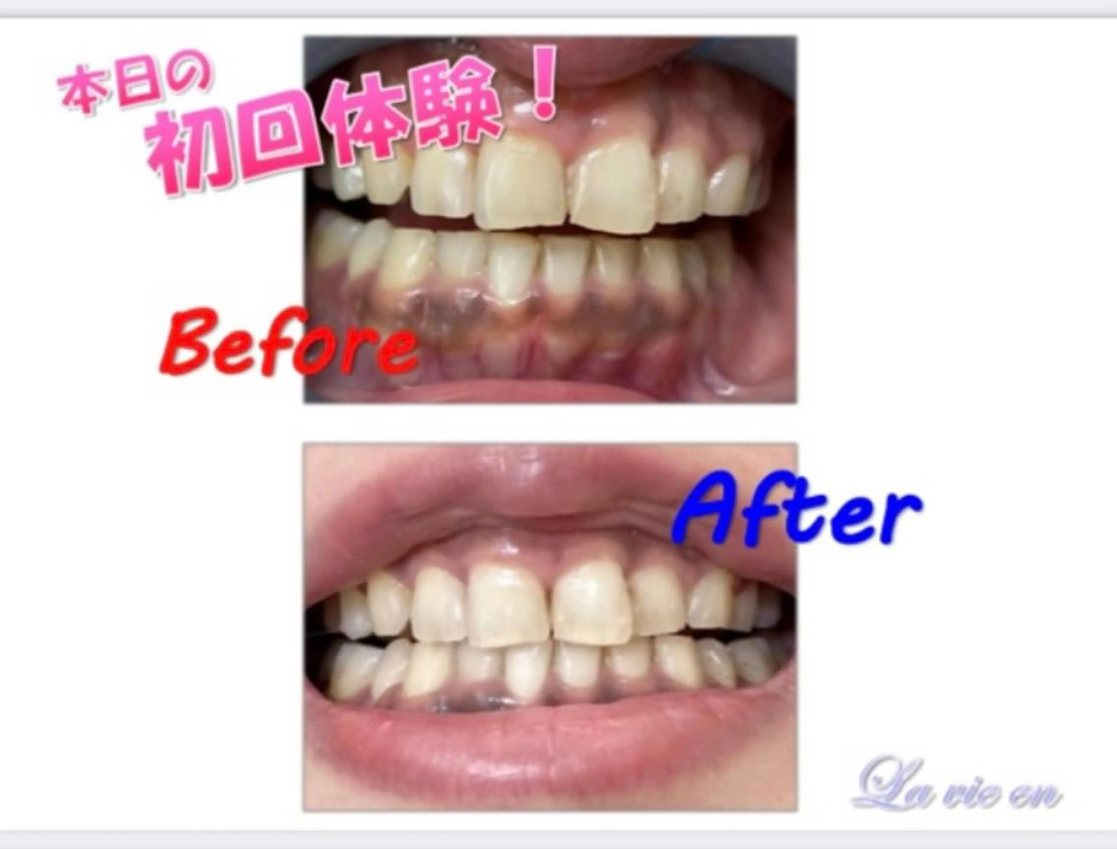 その他 セルフホワイトニングサロン　ラヴィアン所属・ホワイトニングサロン La vie enのその他イメージ