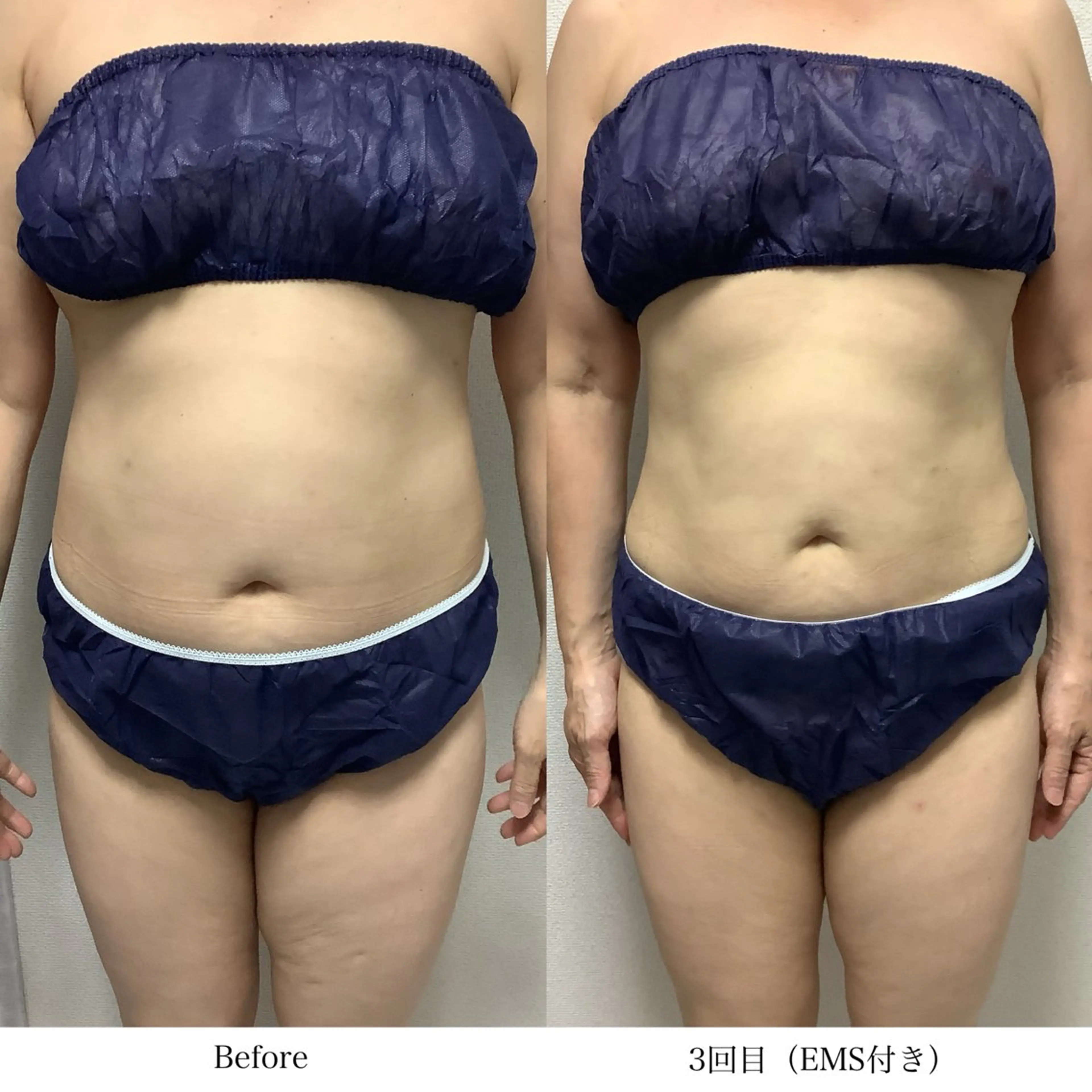 冷却専門店 SLARIのエステ・リラクイメージ