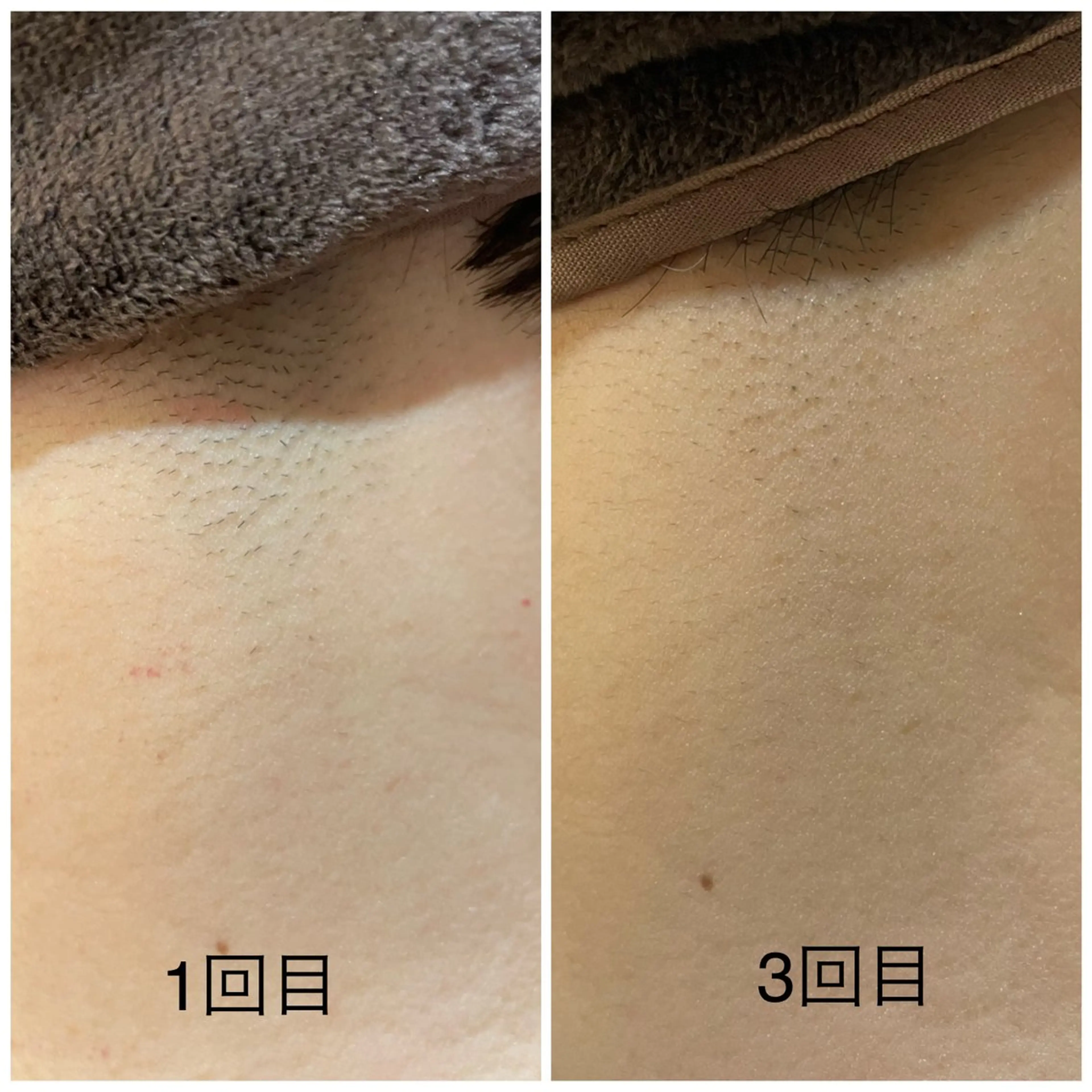 脱毛 leolo武蔵浦和 肌質改善＆脱毛のエステ・リラクイメージ