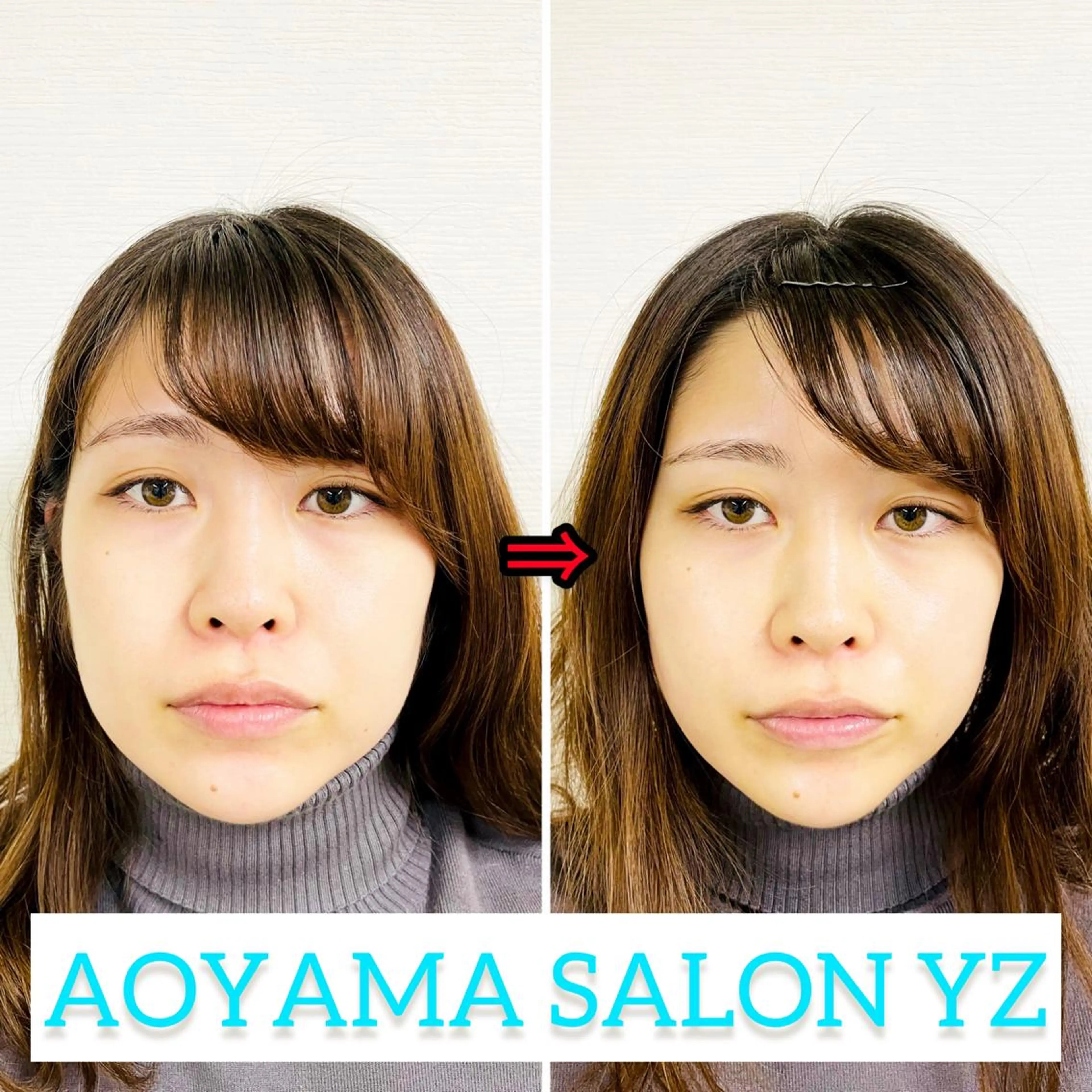 エステ リラク 小顔美容鍼専門サロン 渋谷YZのエステ・リラクイメージ