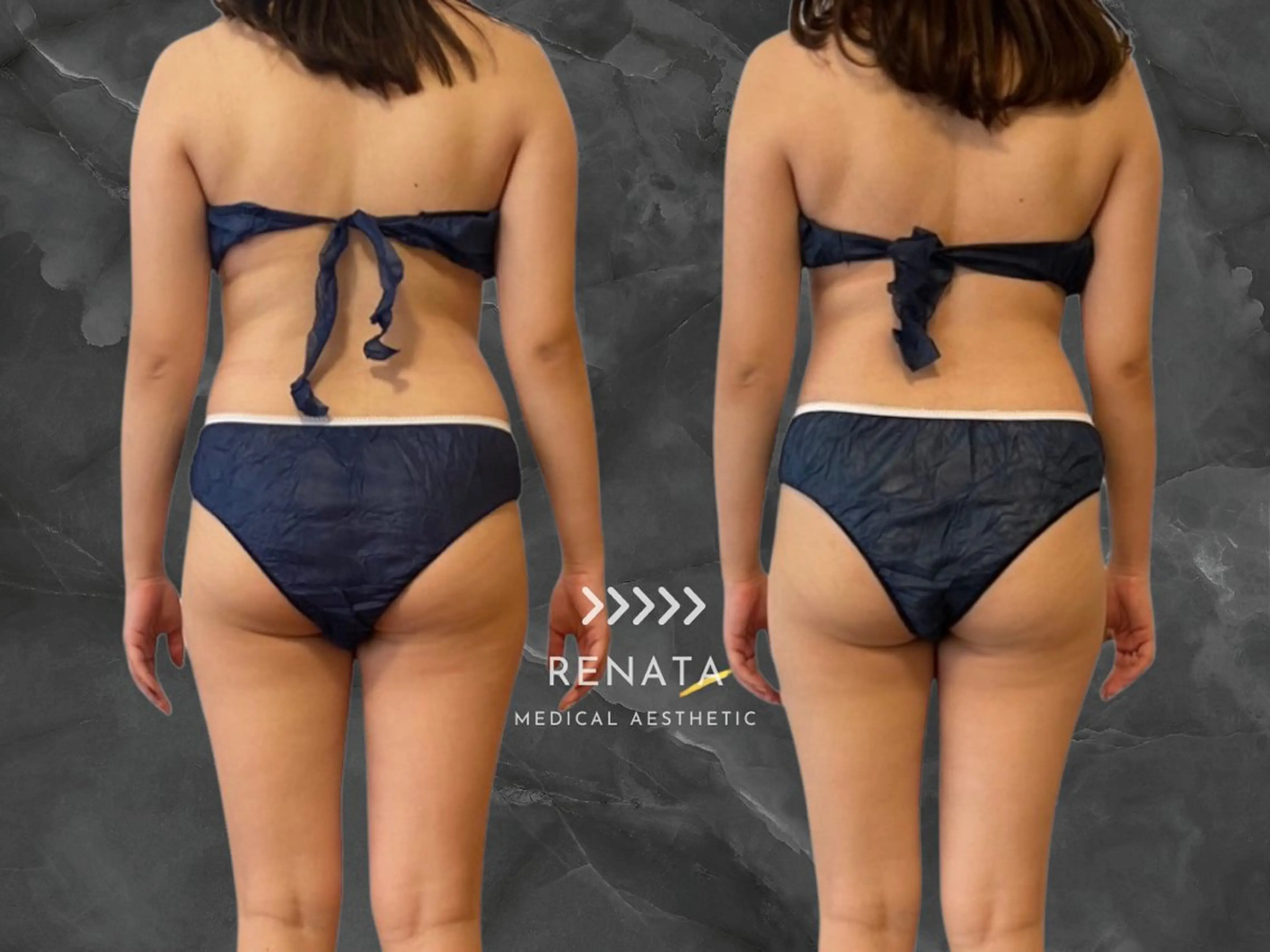 RENATA🕊 脂肪冷却専門店六本木のエステ・リラクイメージ