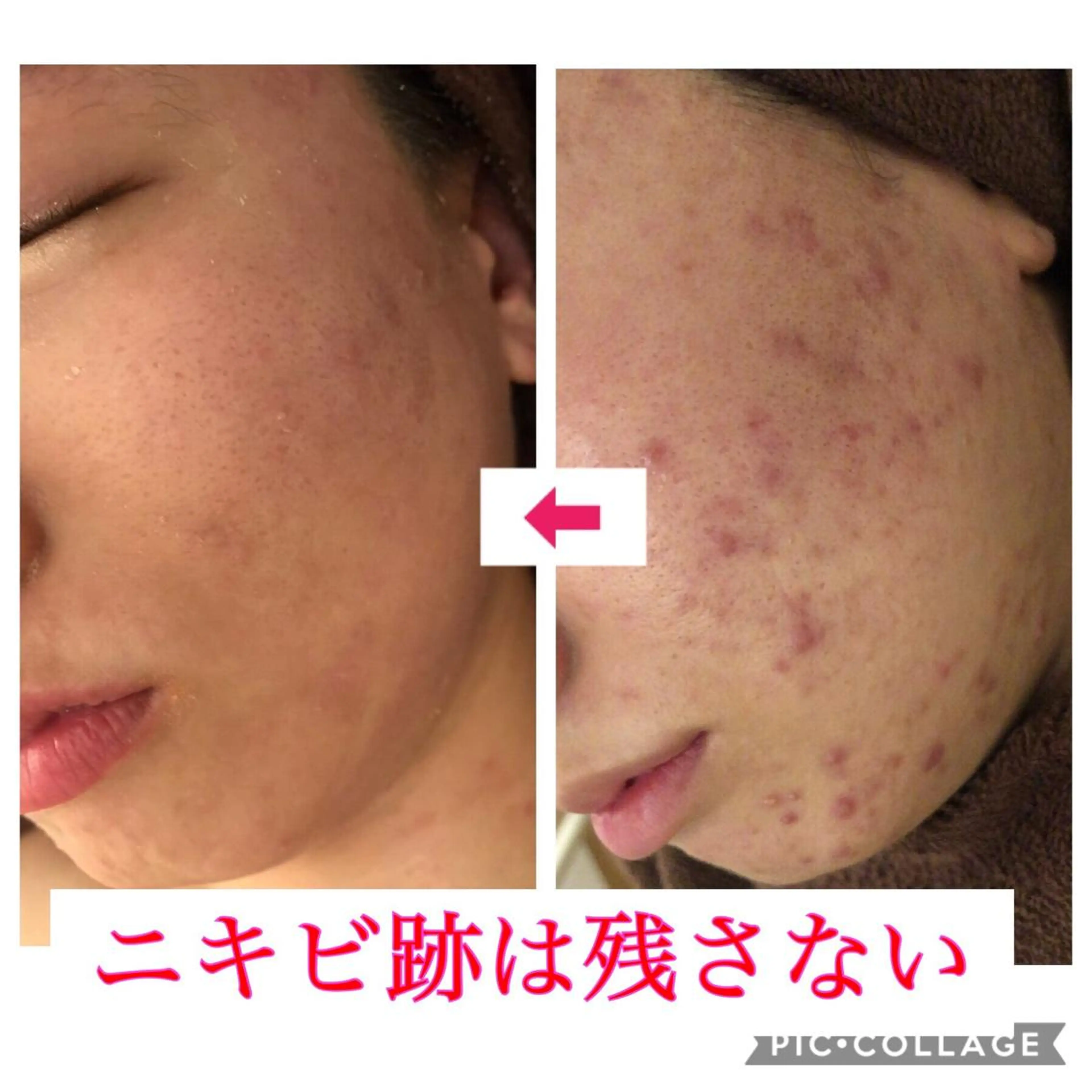 セミロング カラー パーマ ヘアアレンジ メンズ キッズ ネイル マツエク・マツパ エステ リラク 四つ星サロン🎖 腸＆ニキビケアに特化のエステ・リラクイメージ