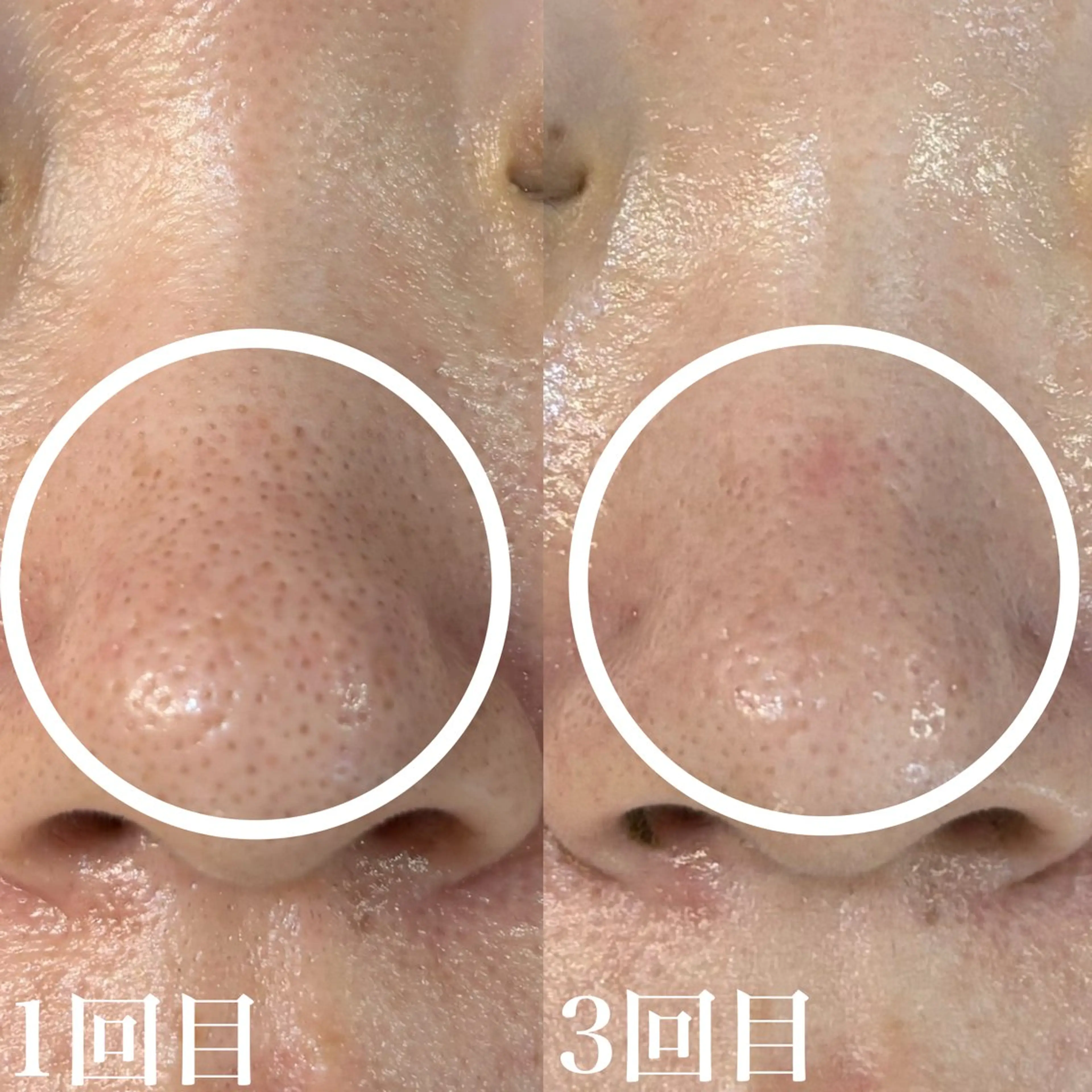 エステ WHITE AQUA 北千住店のエステ・リラクイメージ