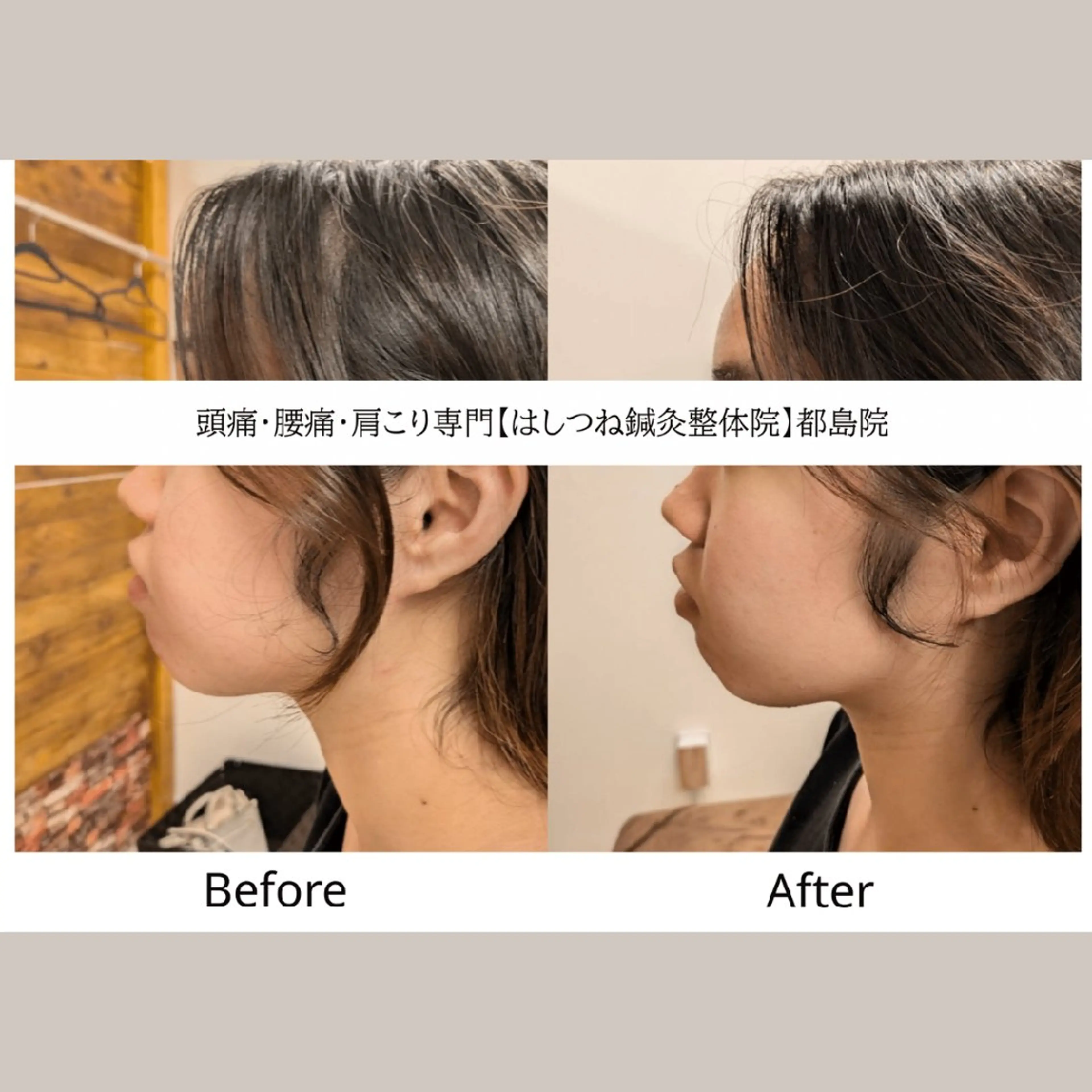 リラク 頭痛・腰痛・美容鍼に 特化してます。　橋岡のエステ・リラクイメージ