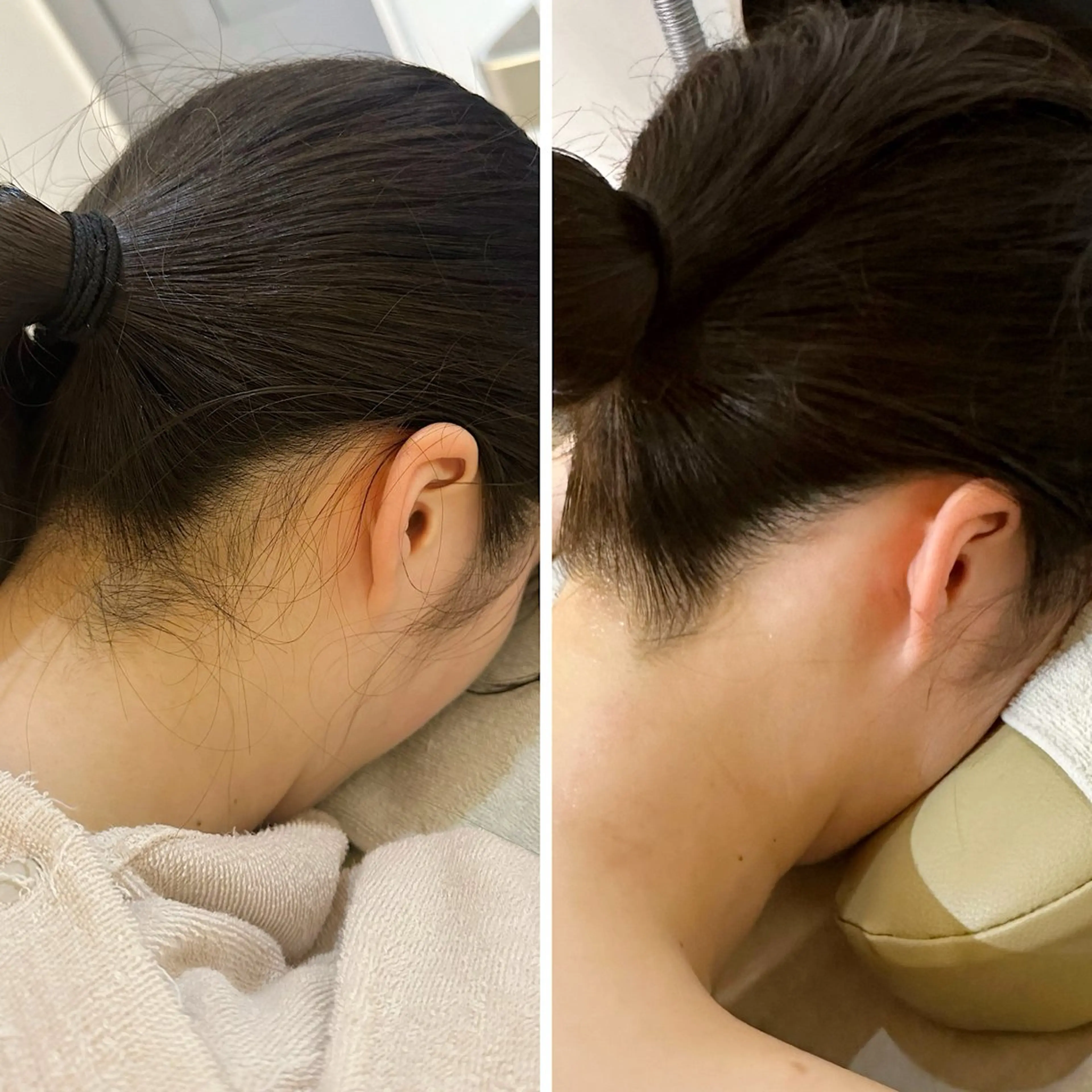 脱毛 うなじ脱毛/美肌脱毛 LABELのエステ・リラクイメージ