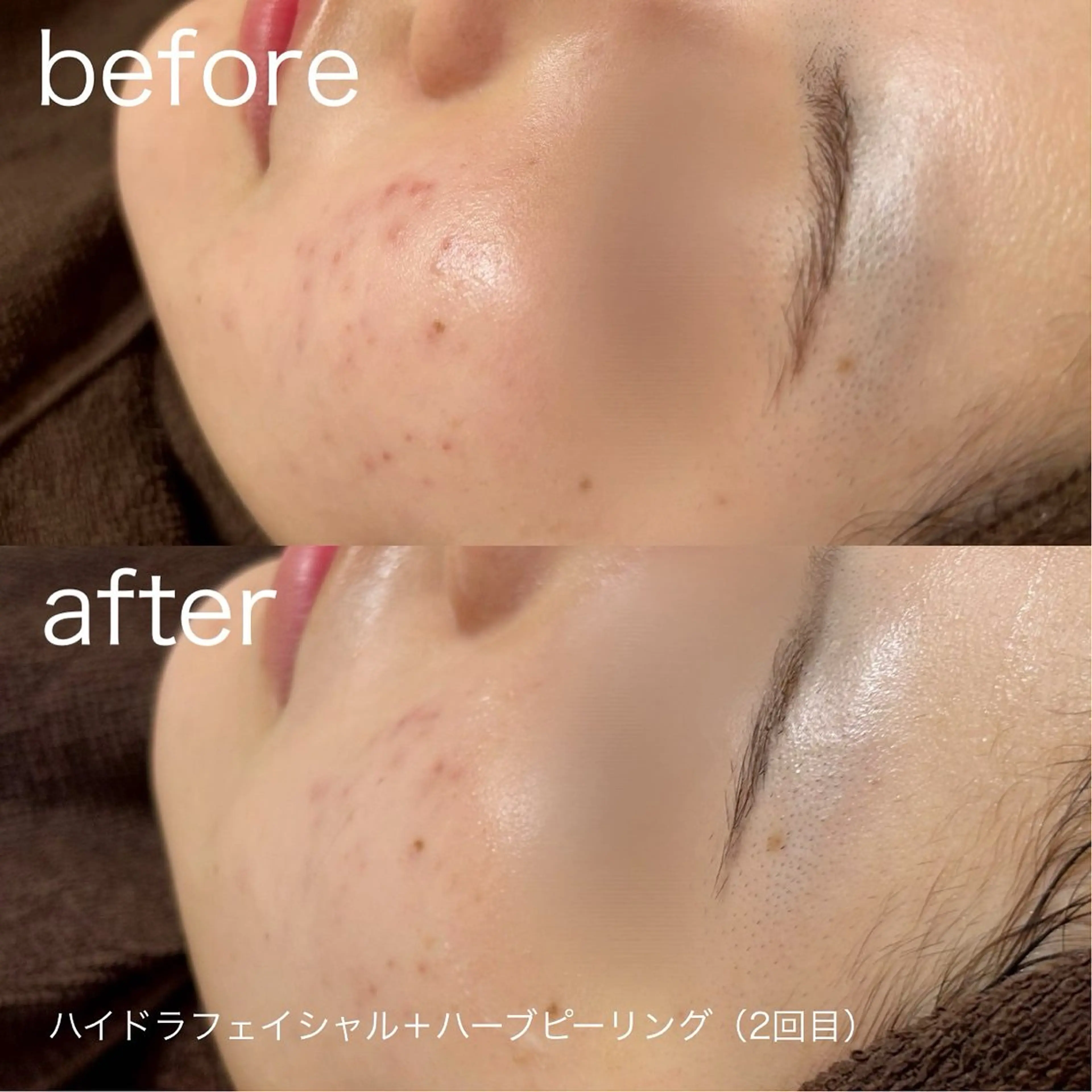 その他 lulularico Yu🫧のエステ・リラクイメージ