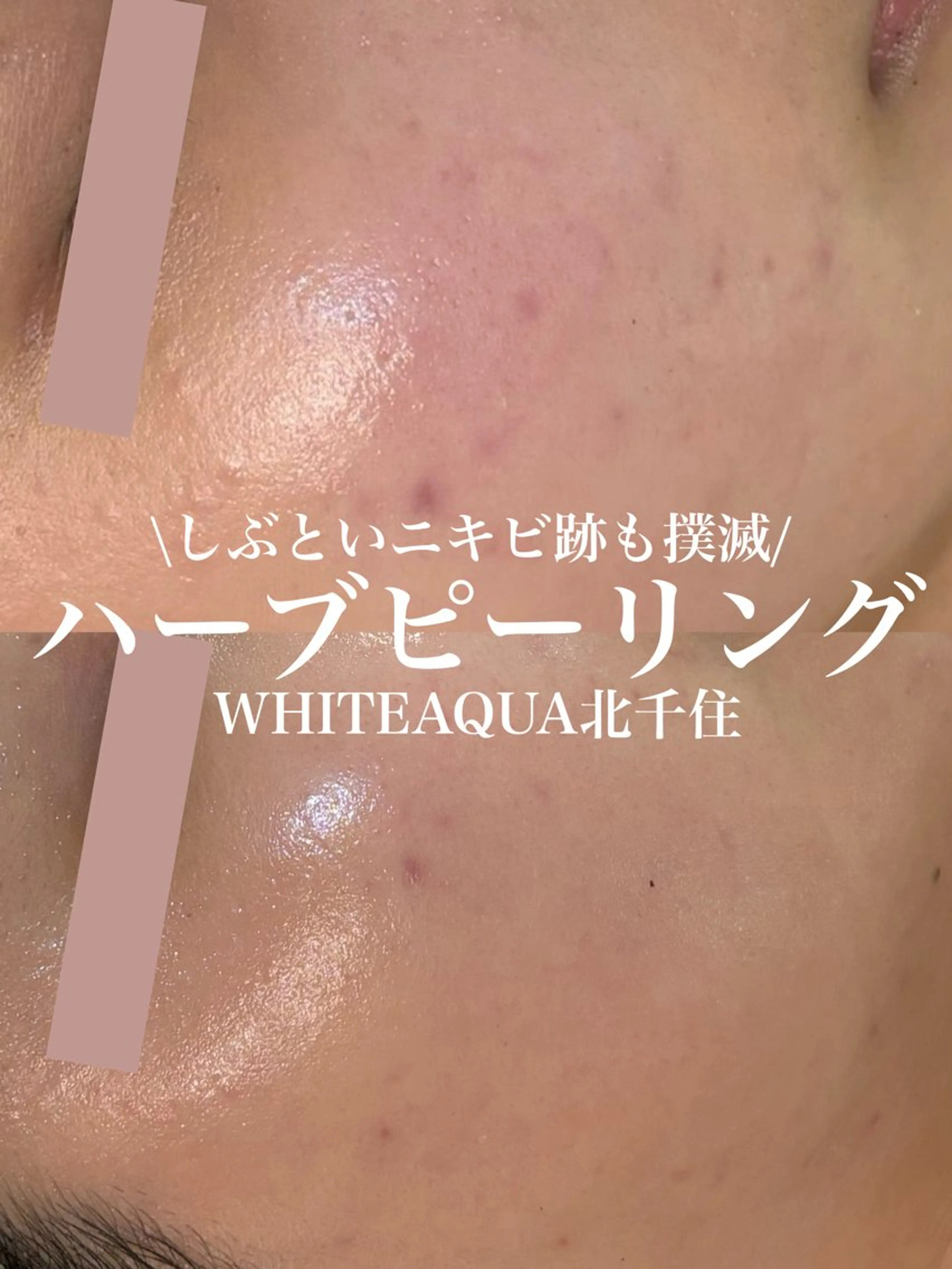 エステ WHITE AQUA 北千住店のエステ・リラクイメージ