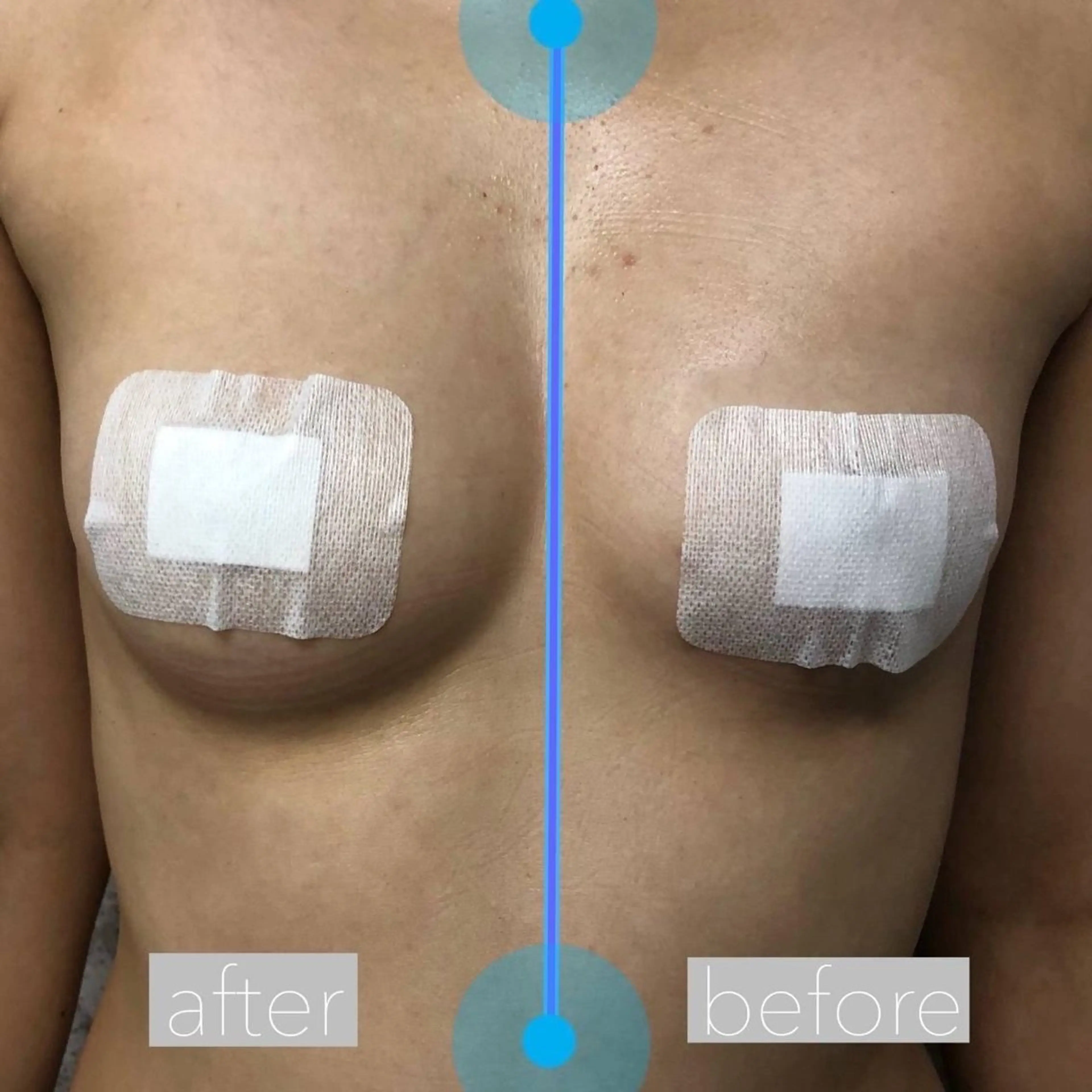 エステ ニキビ、痩身、脱毛、 サクラチャンスパのエステ・リラクイメージ