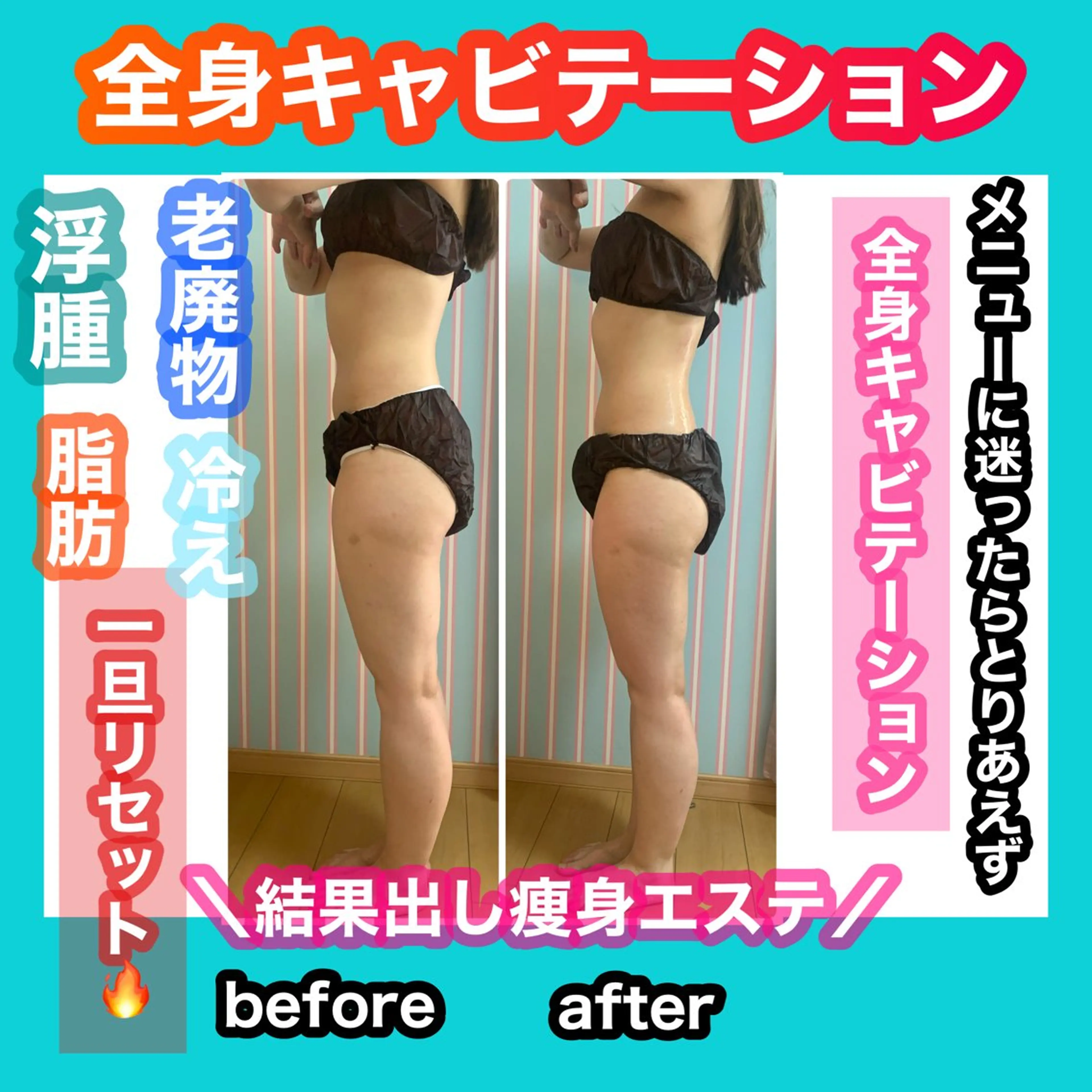 エステ リラク 痩身/脱毛/ネイル HARUKAのエステ・リラクイメージ