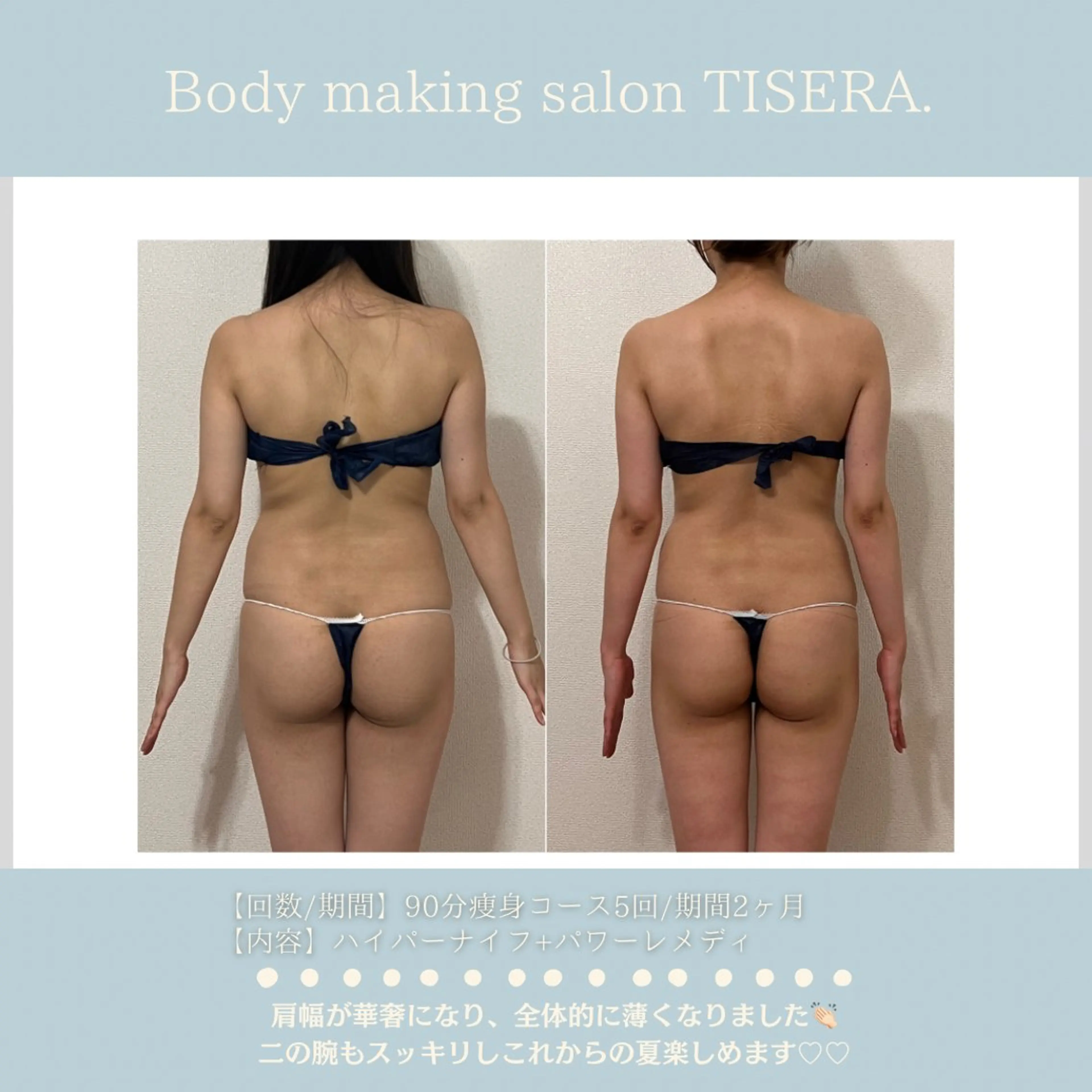 ハイパーナイフ＋パワーレメディ専門サロンTISERA.所属・痩身・小顔・姿勢改善 TISERA.のエステ・リラクイメージ