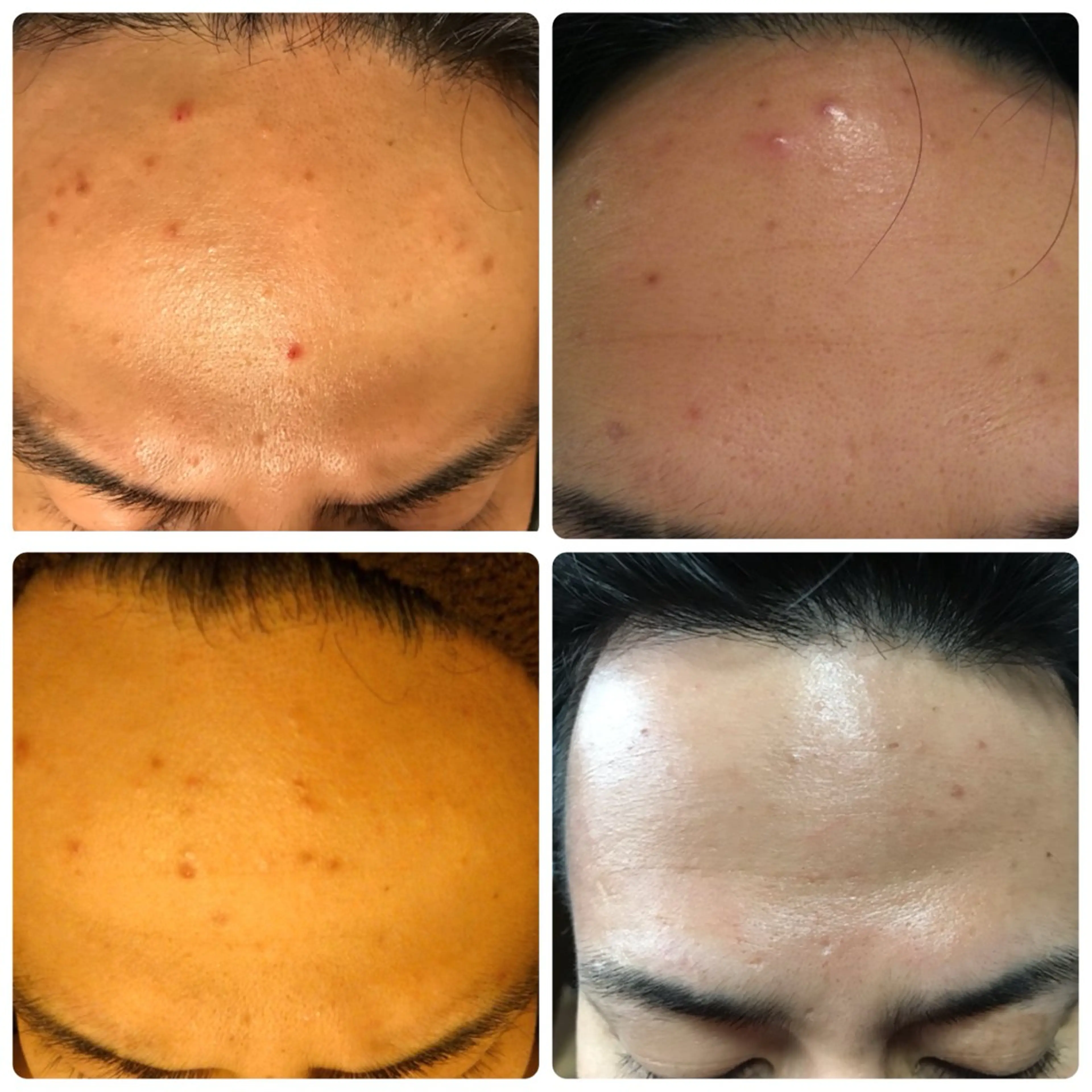 ピーリングサロン シャンテール所属・ピーリングサロン シャンテールのエステ・リラクイメージ