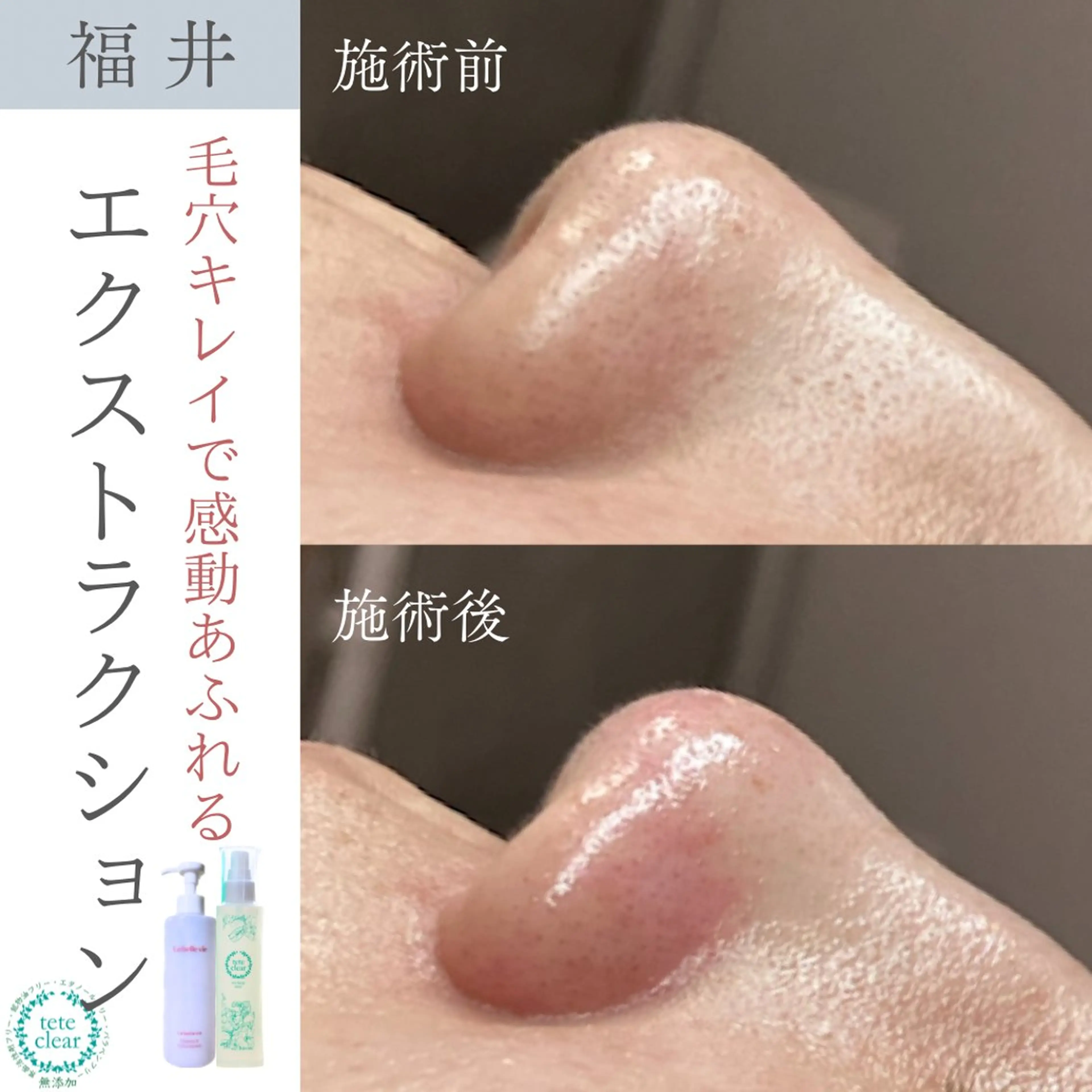 毛穴ケア専門サロン Yourmeユアミーのエステ・リラクイメージ