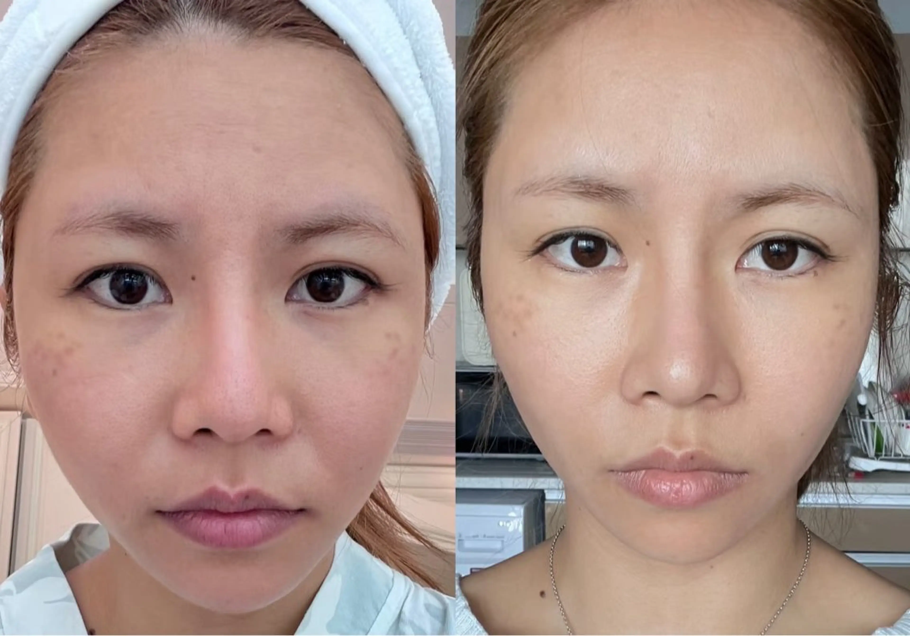 マツエク・マツパ エステ リラク 愛維美水光美肌専門店所属・愛維美水光美肌専門店 メンズレディースokのエステ・リラクイメージ