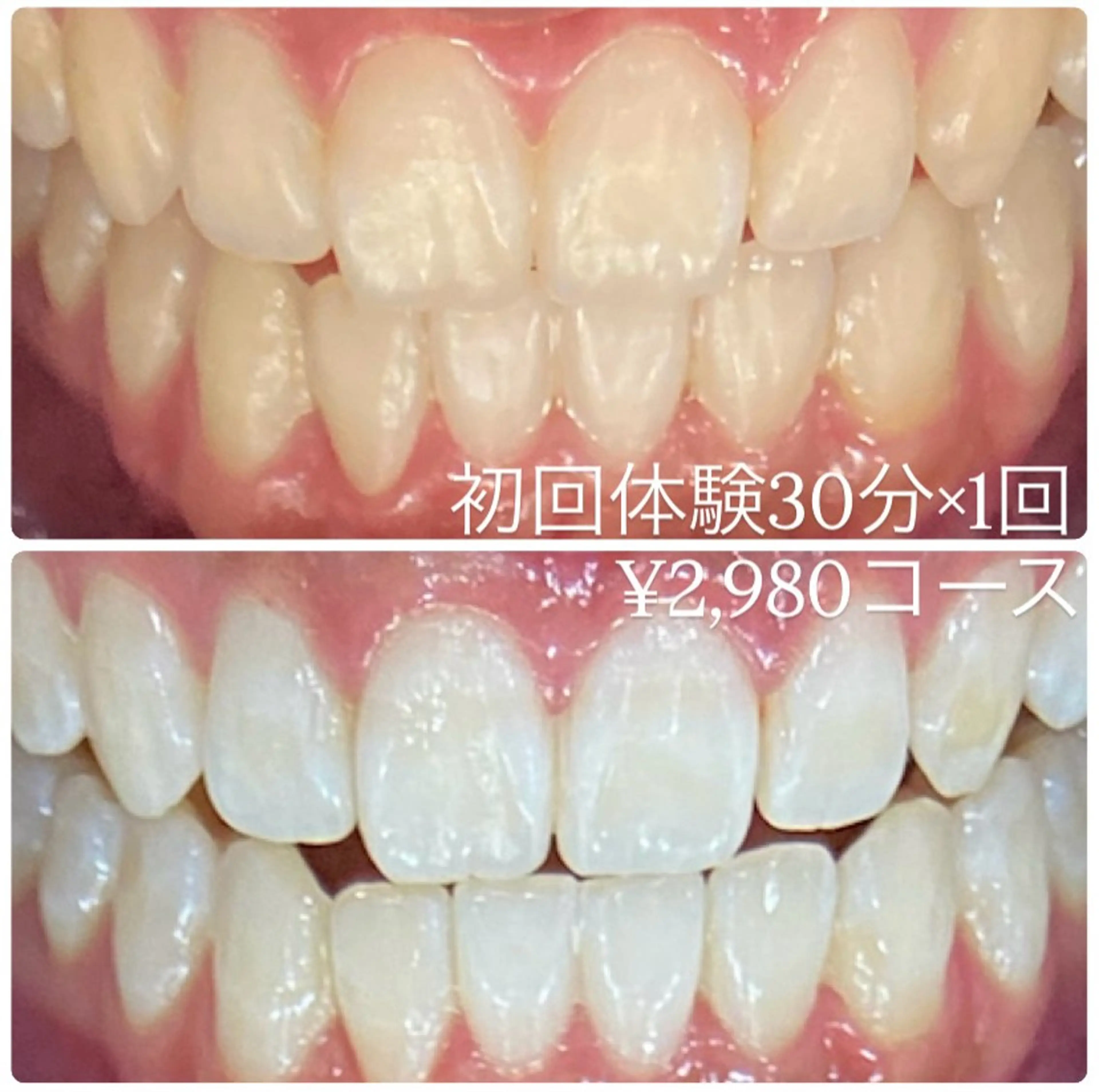 PLATINUM Beauty 横浜店所属・ホワイトニングルーム 横浜店のその他イメージ