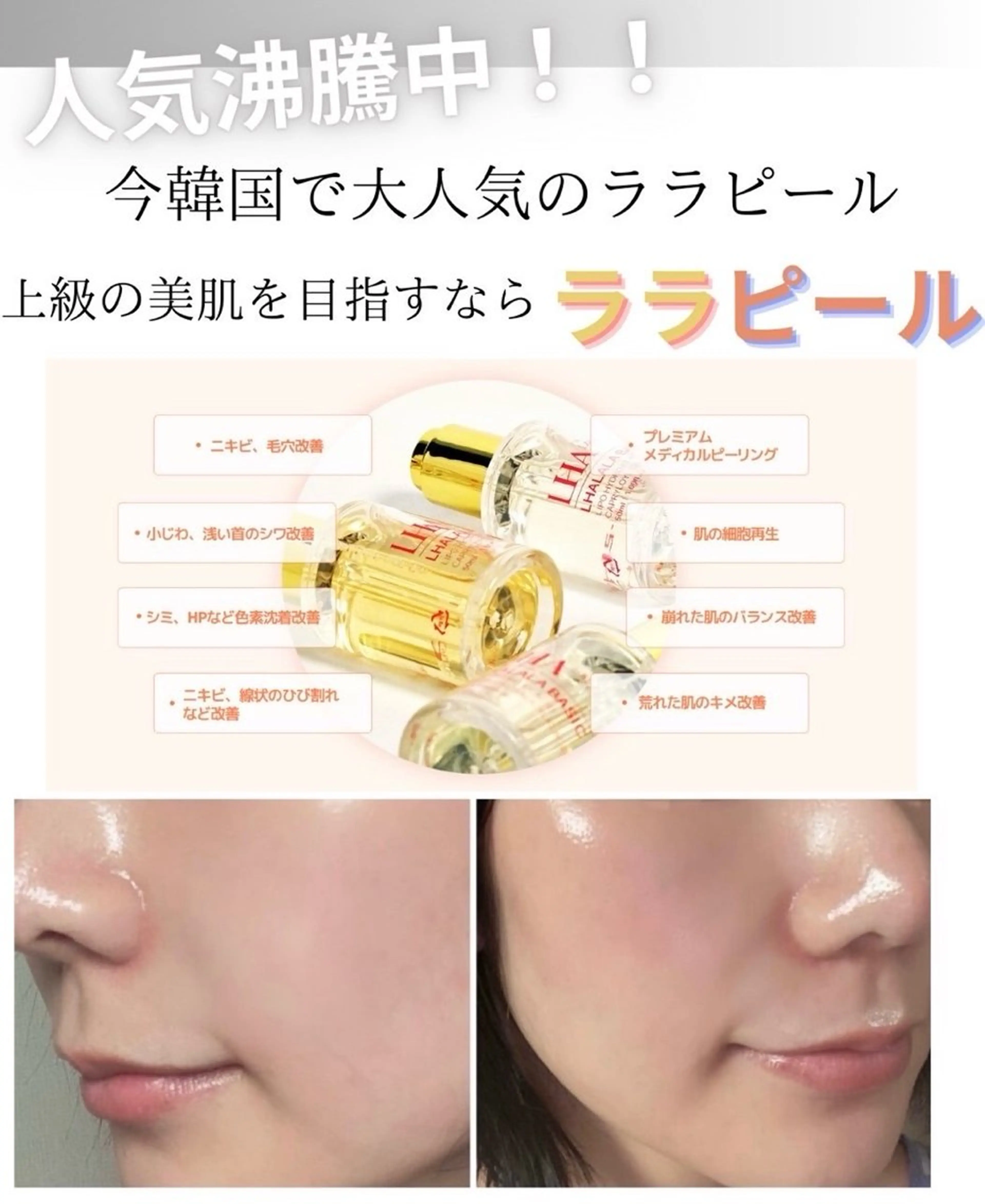 ミニモ会員様限定‼️韓国人気注目のララピール　LHALA PEELの写真