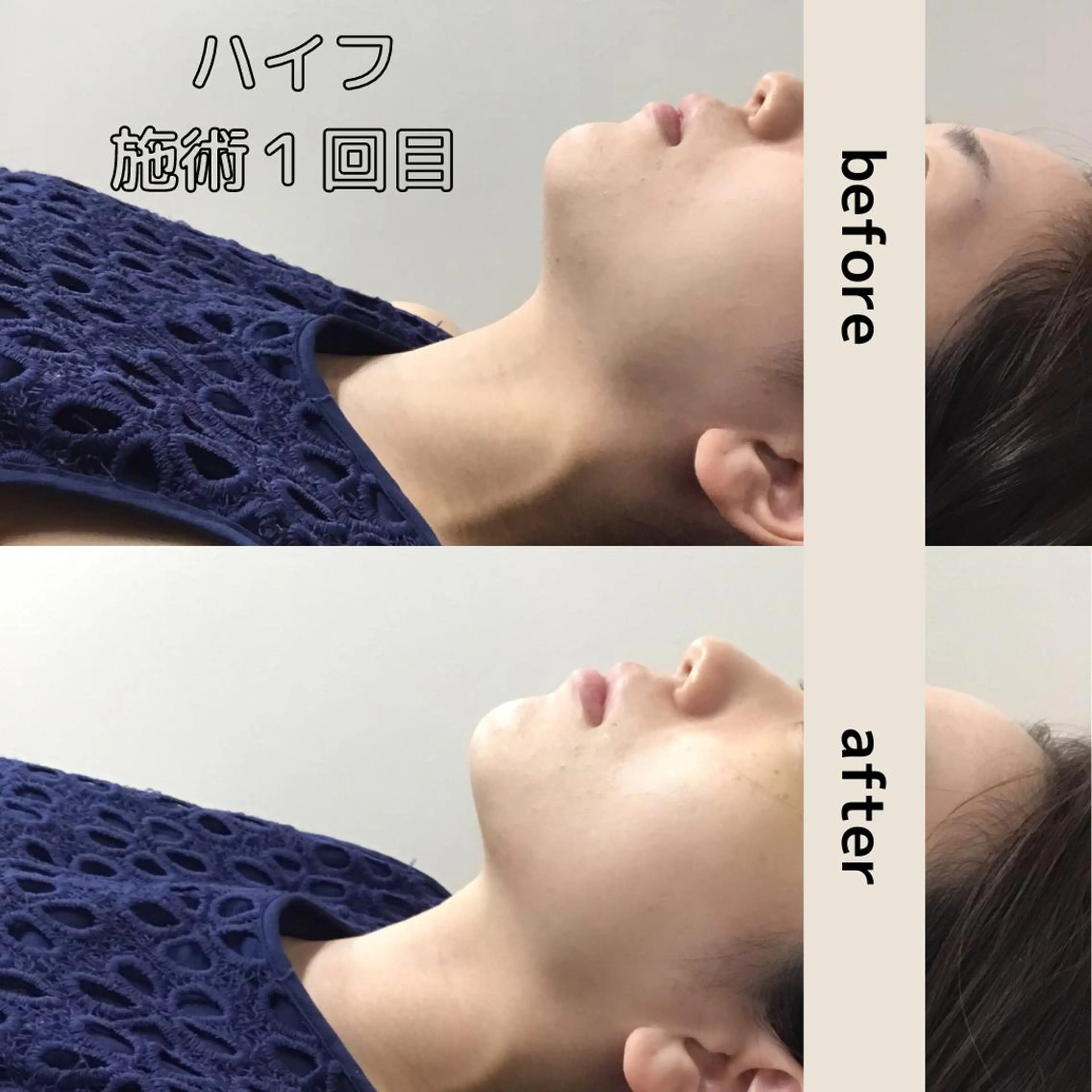 小顔専門アズイズ ビューティー　草津店のエステ・リラクイメージ