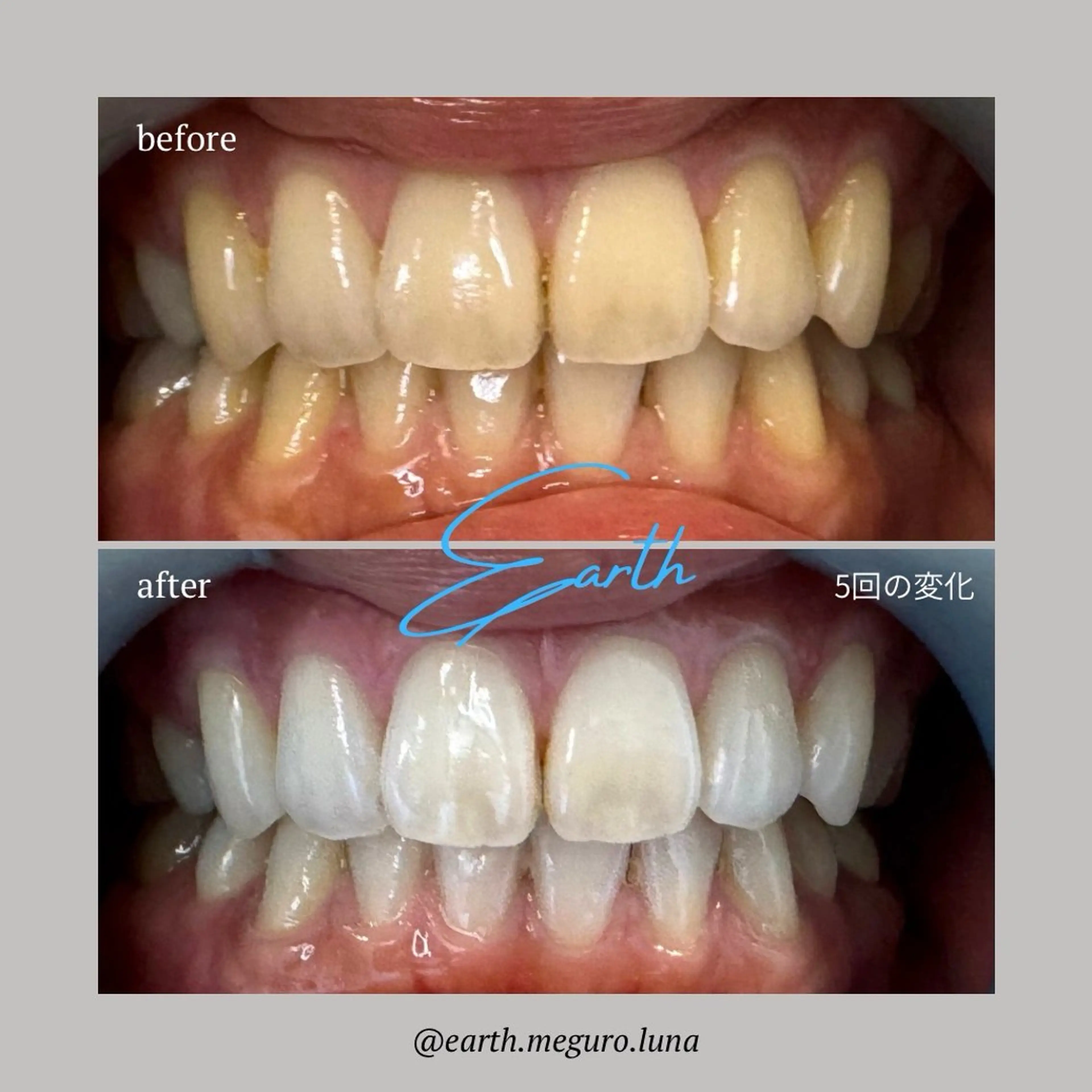 エステ ホワイトニングサロン EARTH目黒店のその他イメージ