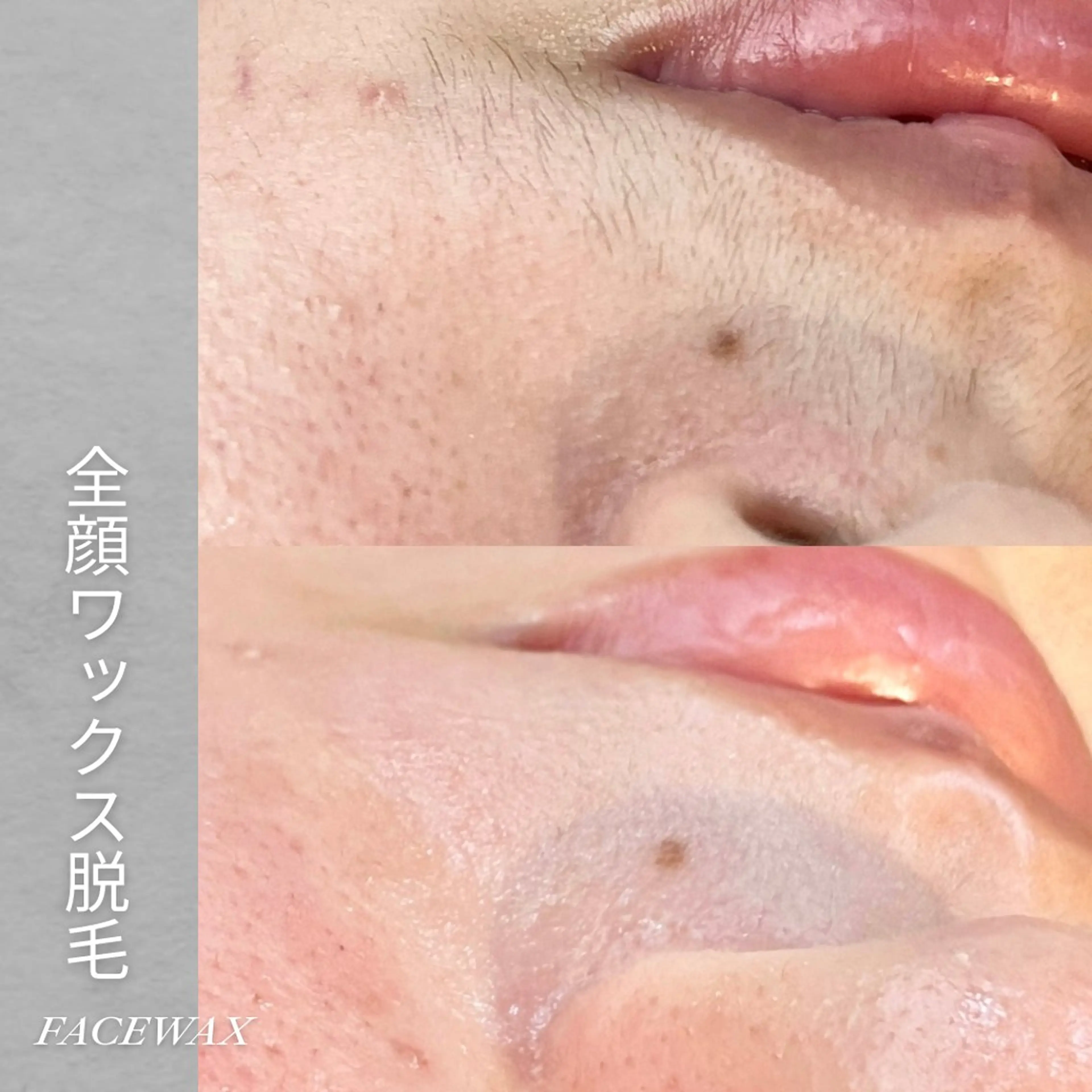 EST BEAUTY所属・顔ワックス脱毛/ ハーブピーリングのエステ・リラクイメージ