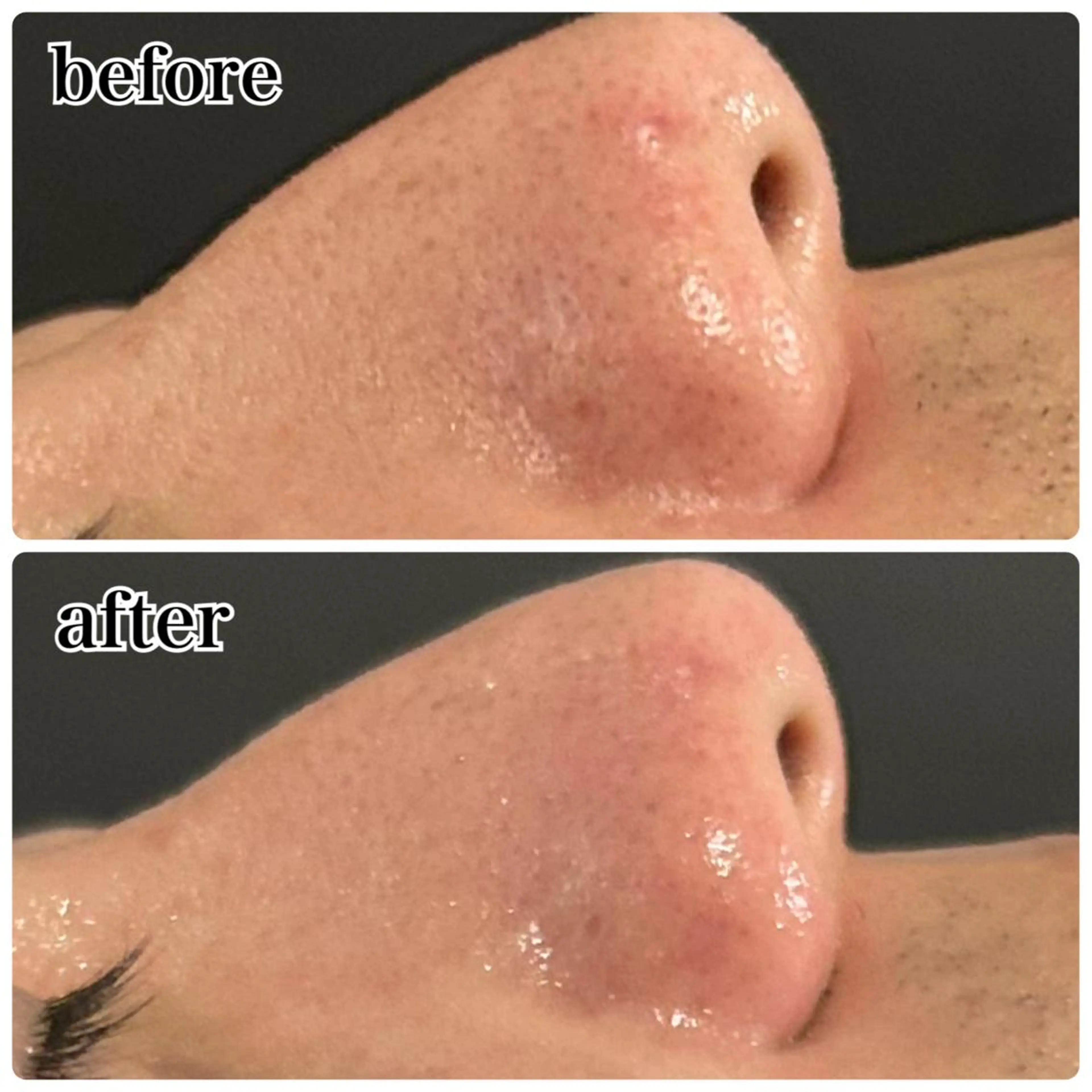 エステ Gemini MIKIのエステ・リラクイメージ