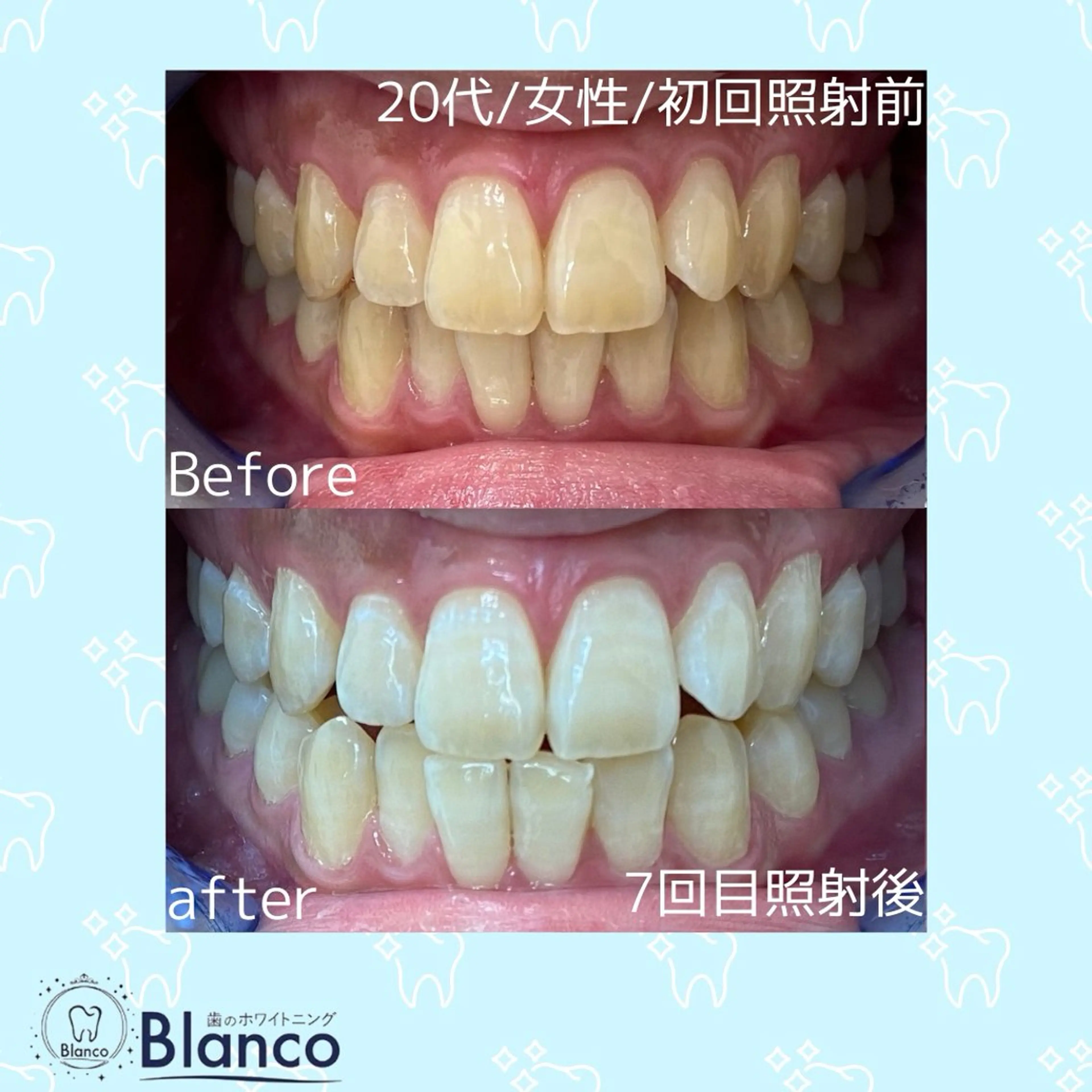 その他 Blanco川口駅前店所属・Blanco 川口駅前店のその他イメージ