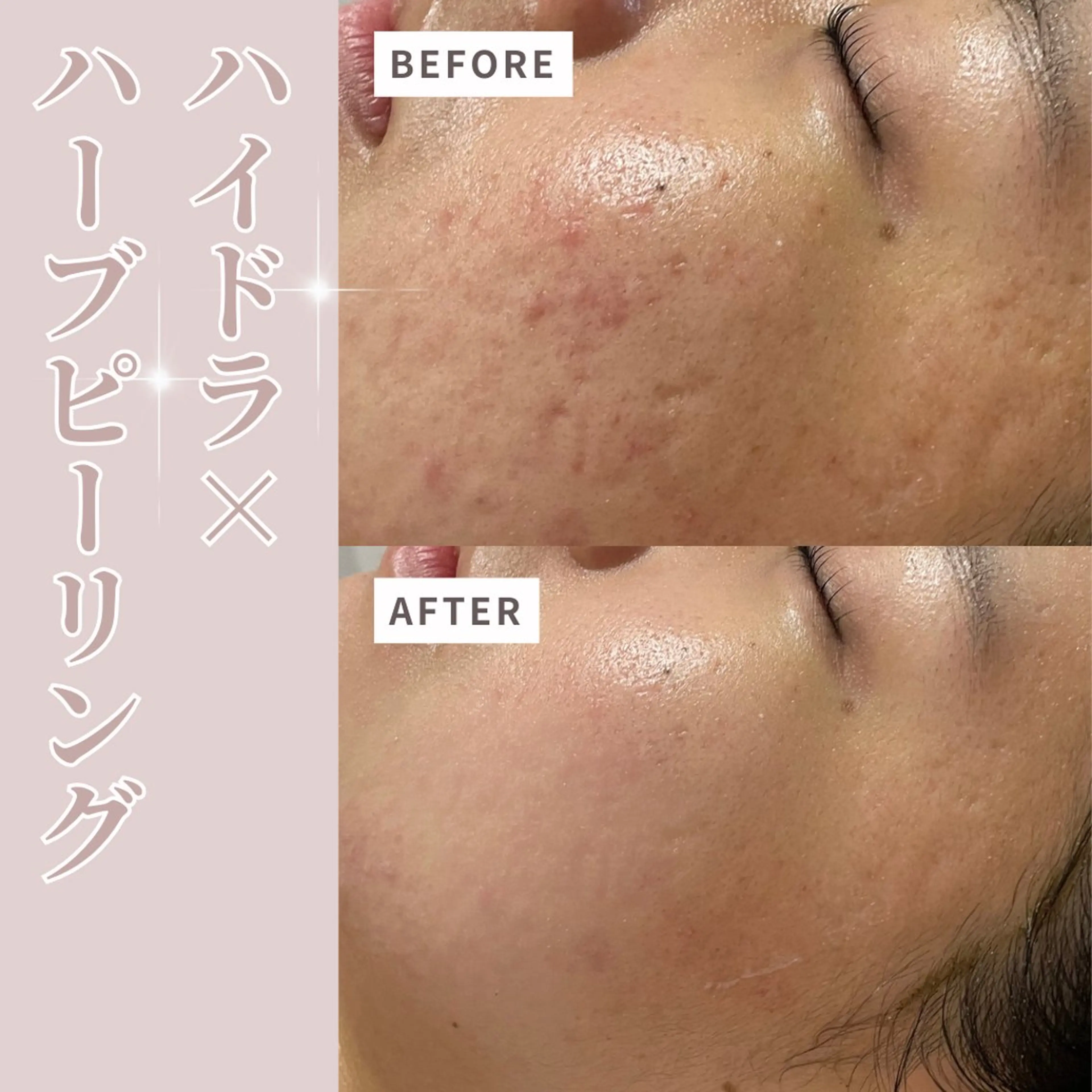 エステ プライベートサロン Belle（ベル）のエステ・リラクイメージ