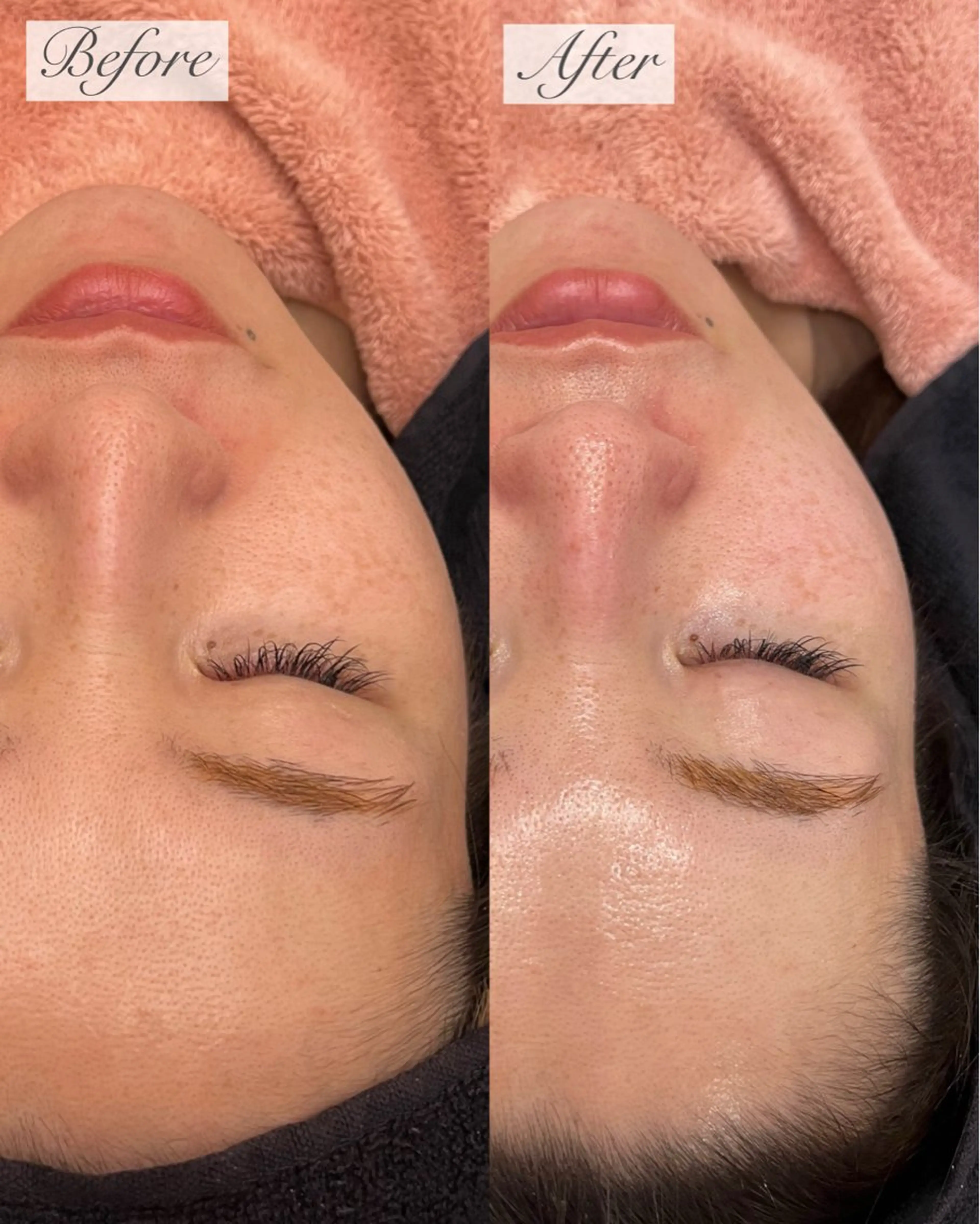 emiluca西目/ 毛穴洗浄/細胞美容のエステ・リラクイメージ