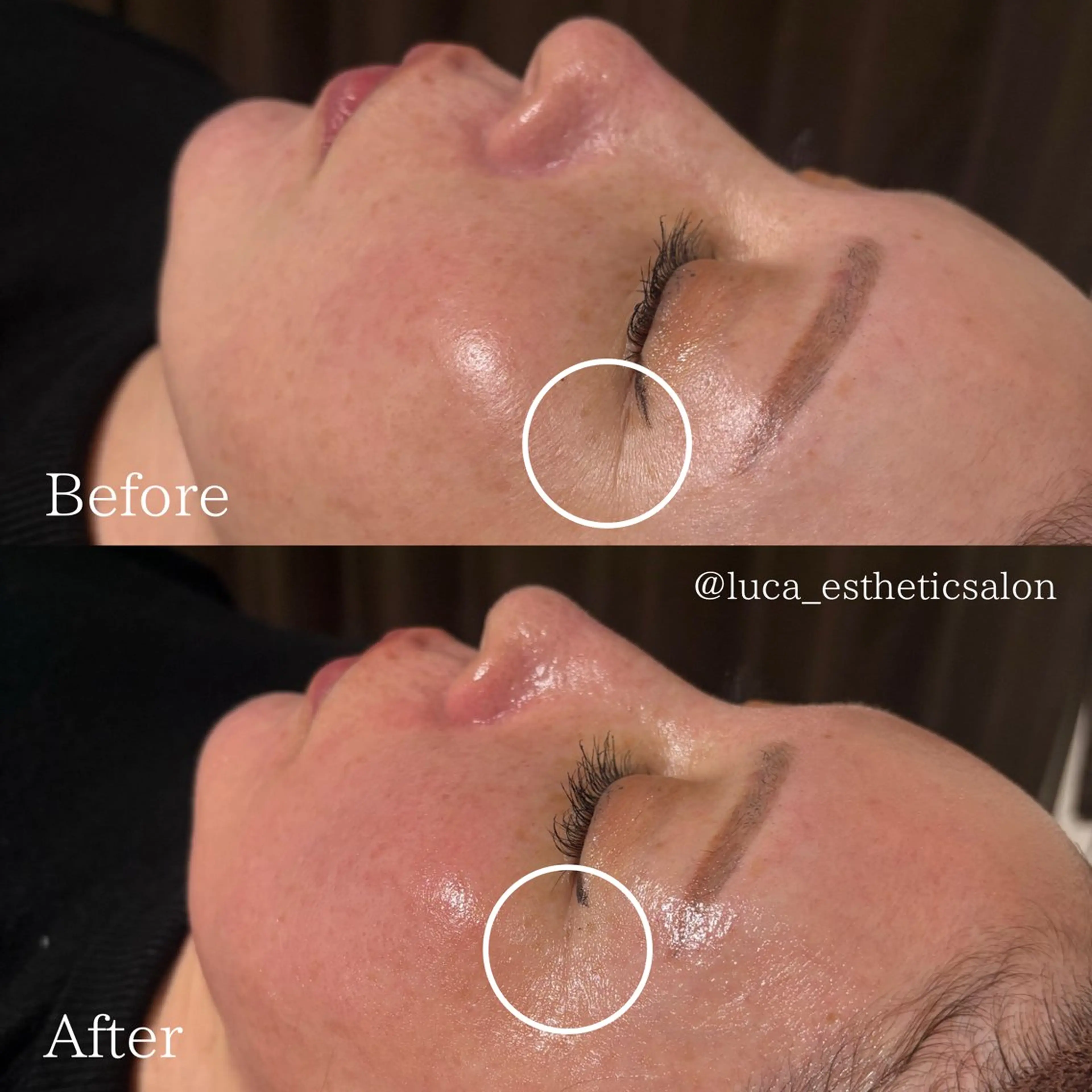 Luca所属・Luca ﾙｶのエステ・リラクイメージ