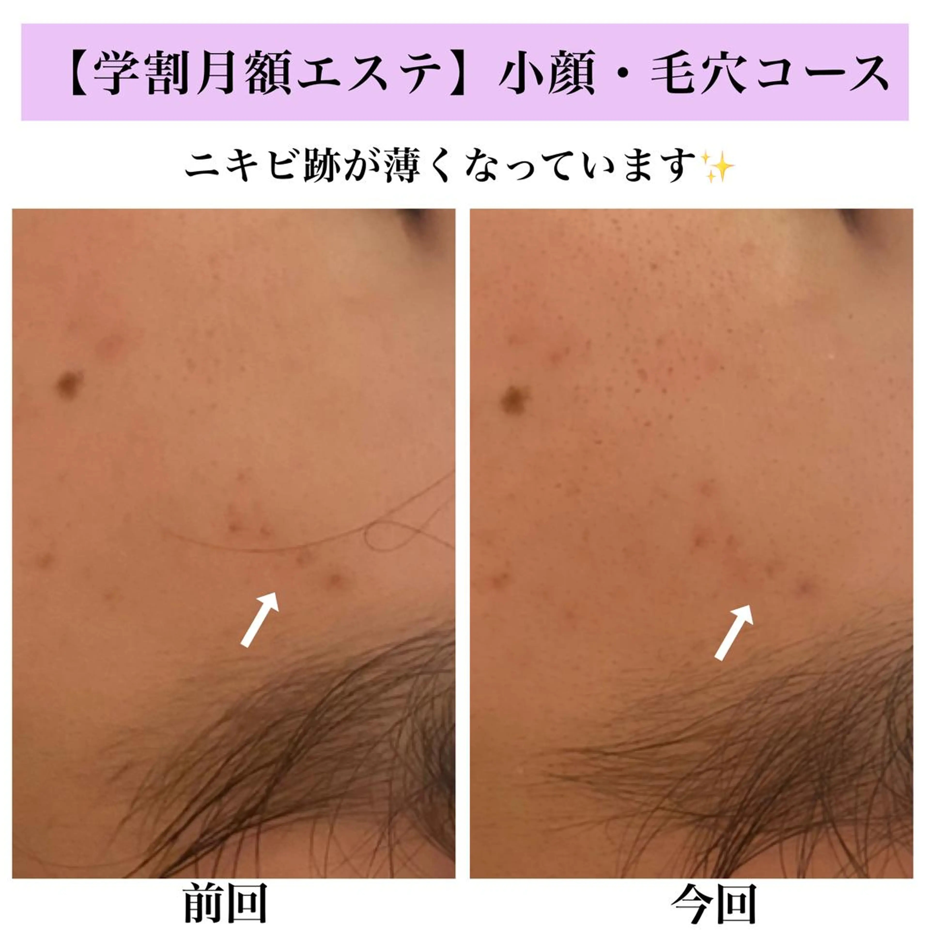 Bellesthe （ベルエステ）のエステ・リラクイメージ