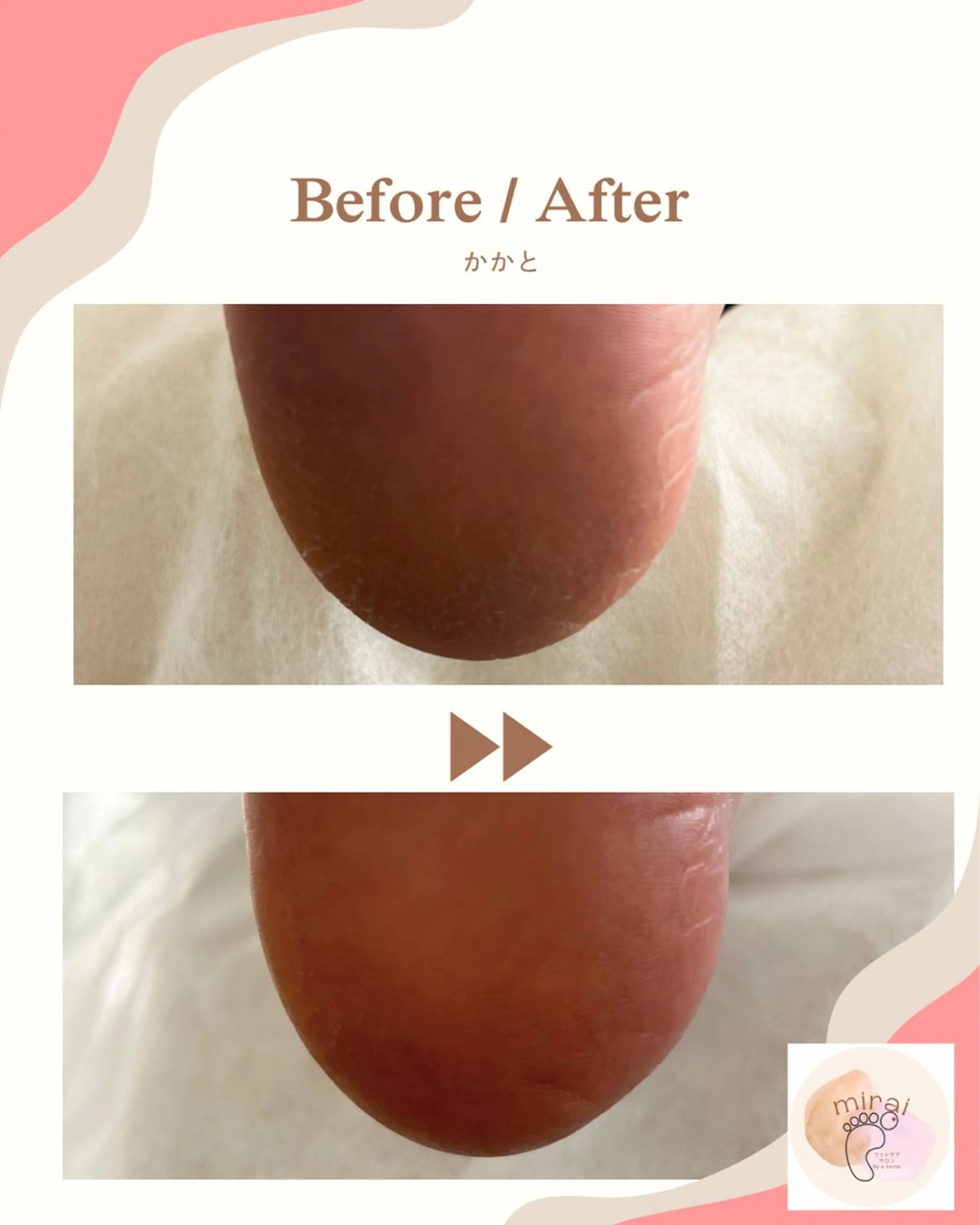 その他 フットケアサロン miraiのその他イメージ