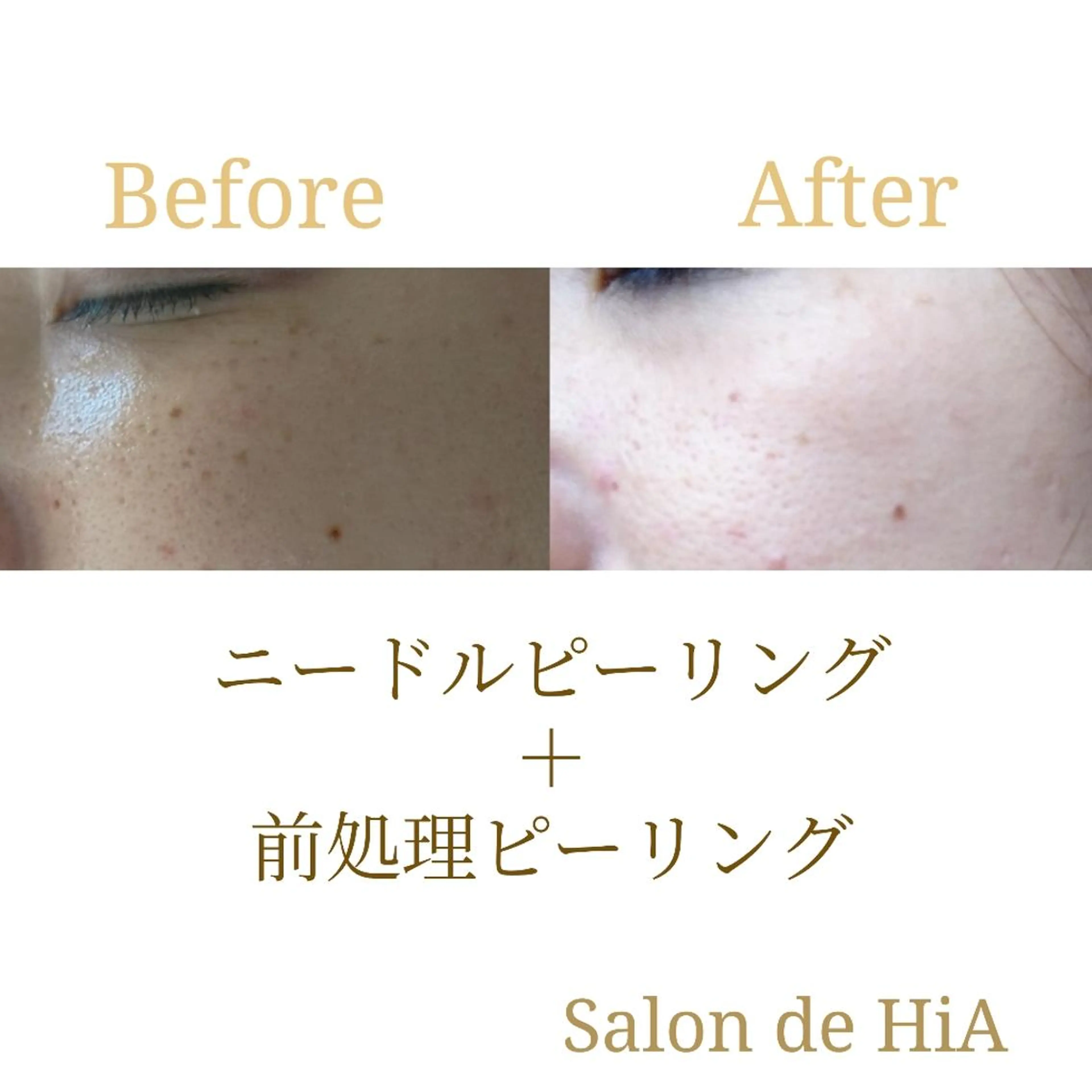 エステ Salon de  HiAのエステ・リラクイメージ