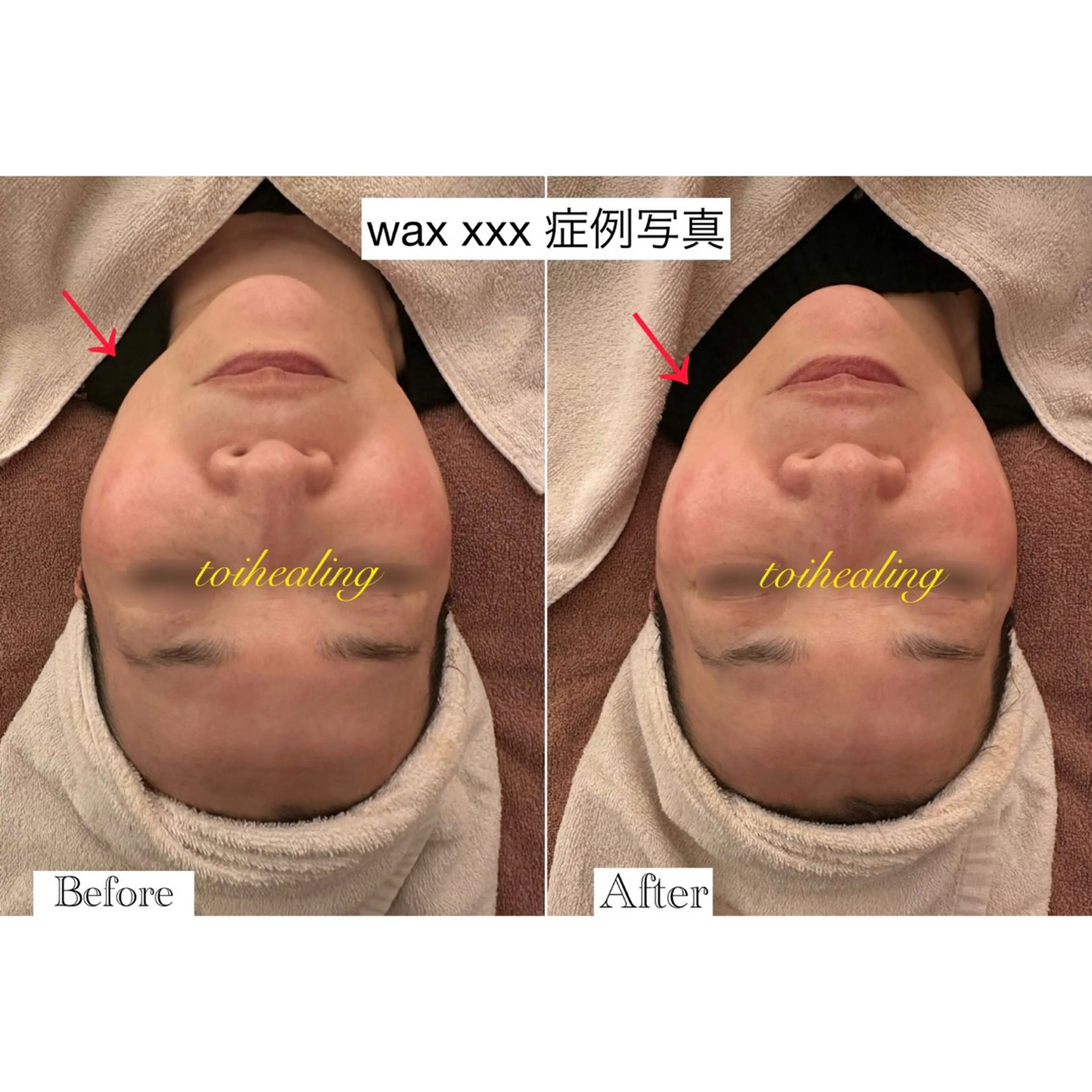 肌質改善サロン　toihealing所属・肌質改善サロン トワヒーリングのエステ・リラクイメージ