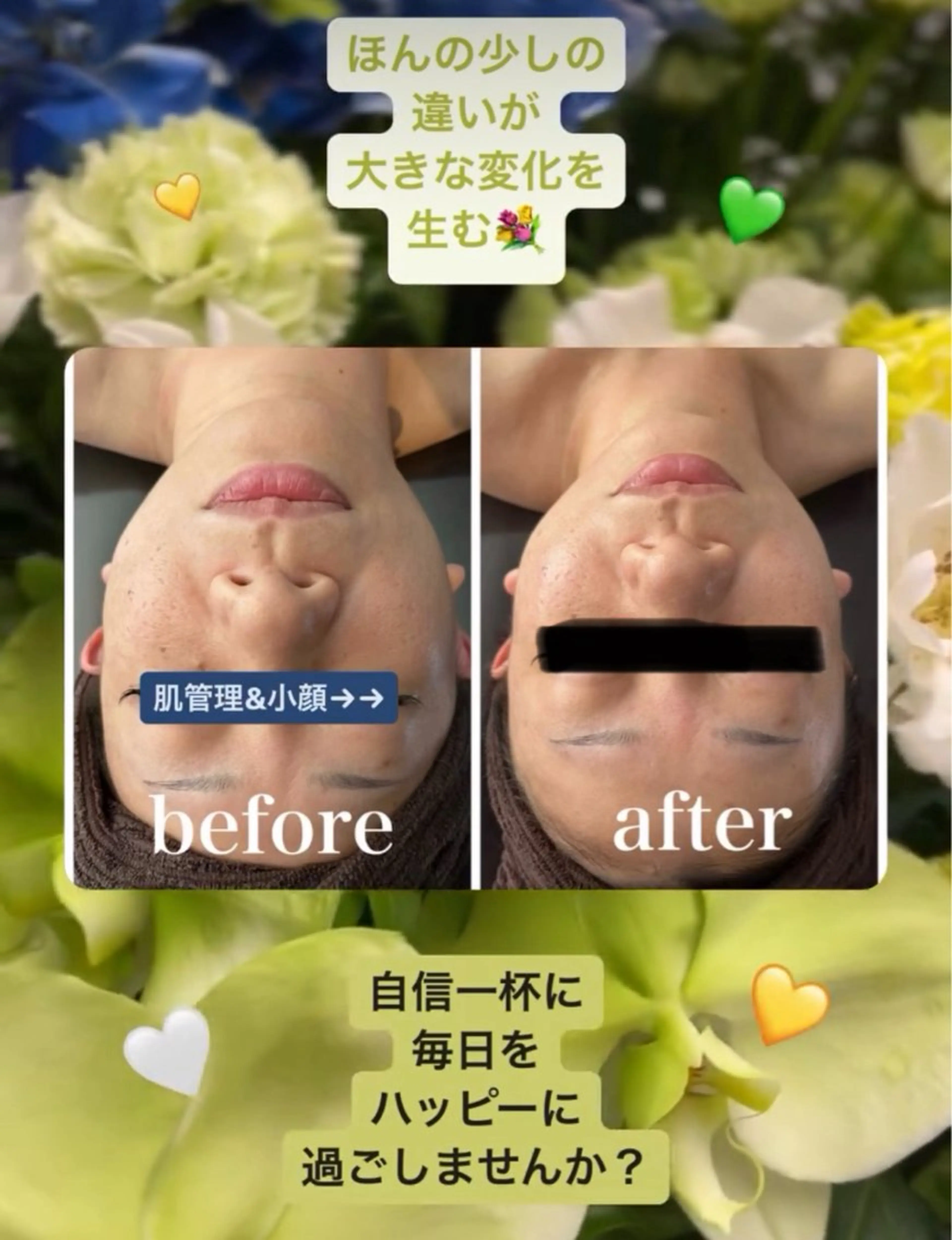 ■超絶小顔＆肌管理室■所属・🦋整形級の究極美顔 本格韓国式小顔🦋のエステ・リラクイメージ