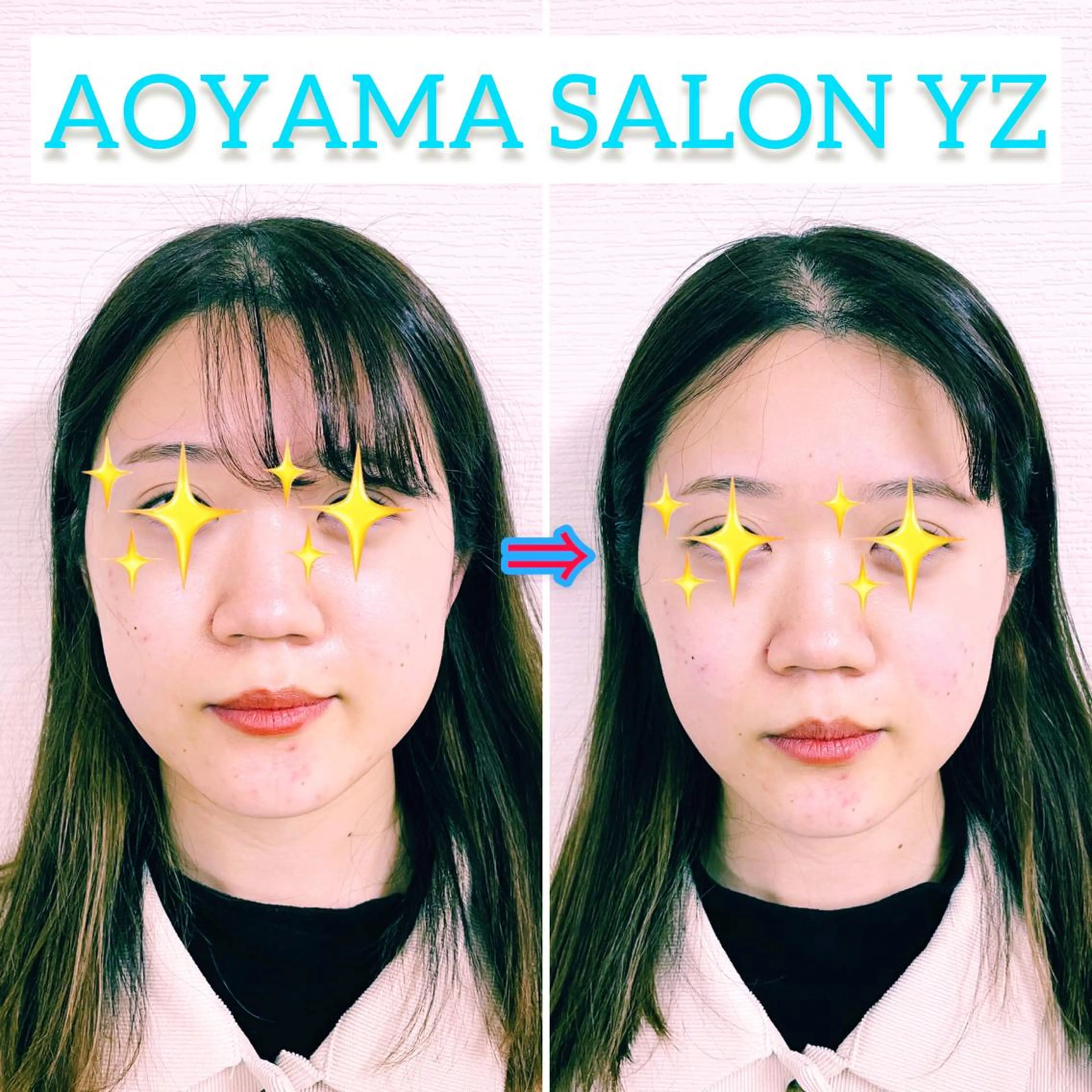 エステ リラク 小顔美容鍼専門サロン 渋谷YZのエステ・リラクイメージ