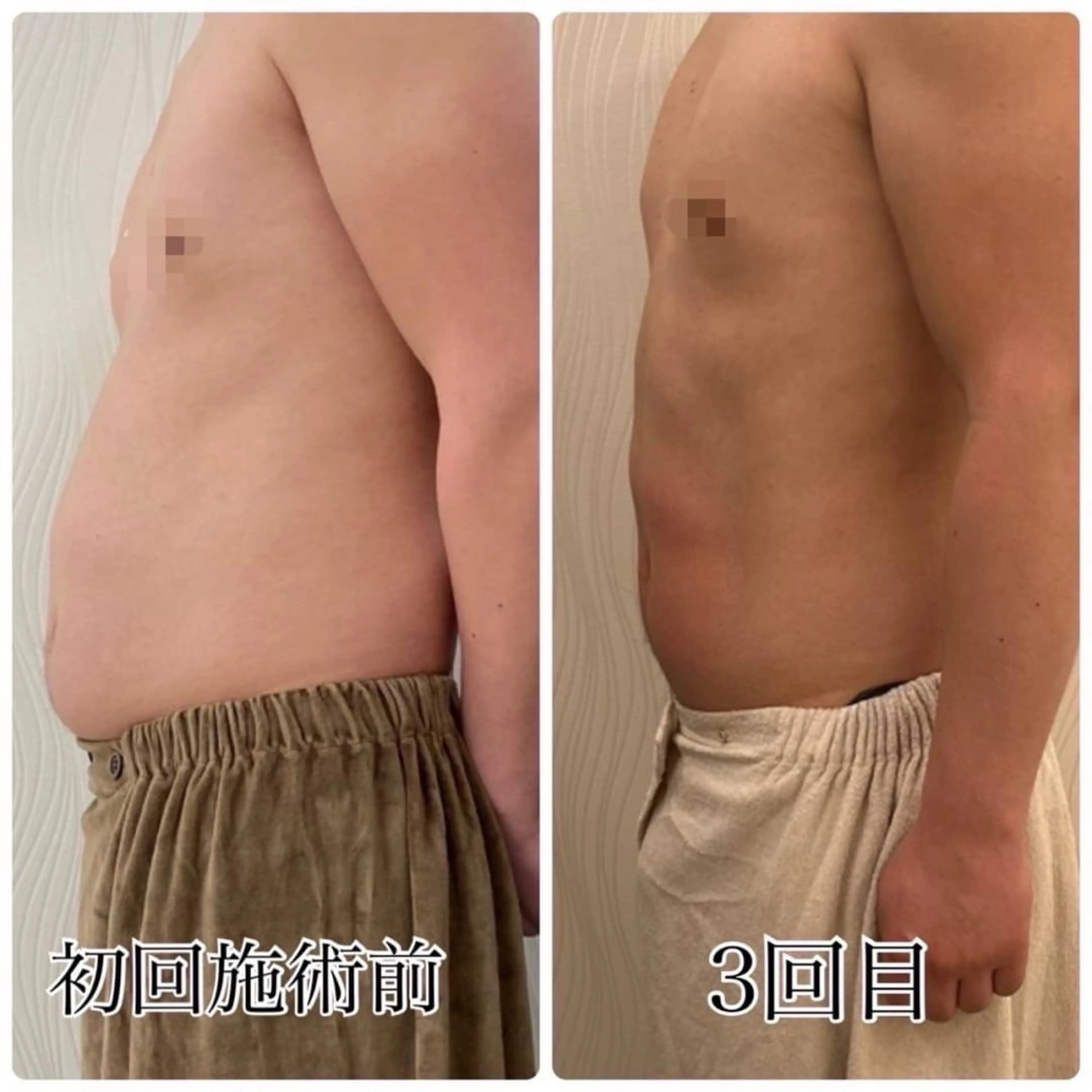 バストアップ/ ボディメイク　新宅のエステ・リラクイメージ