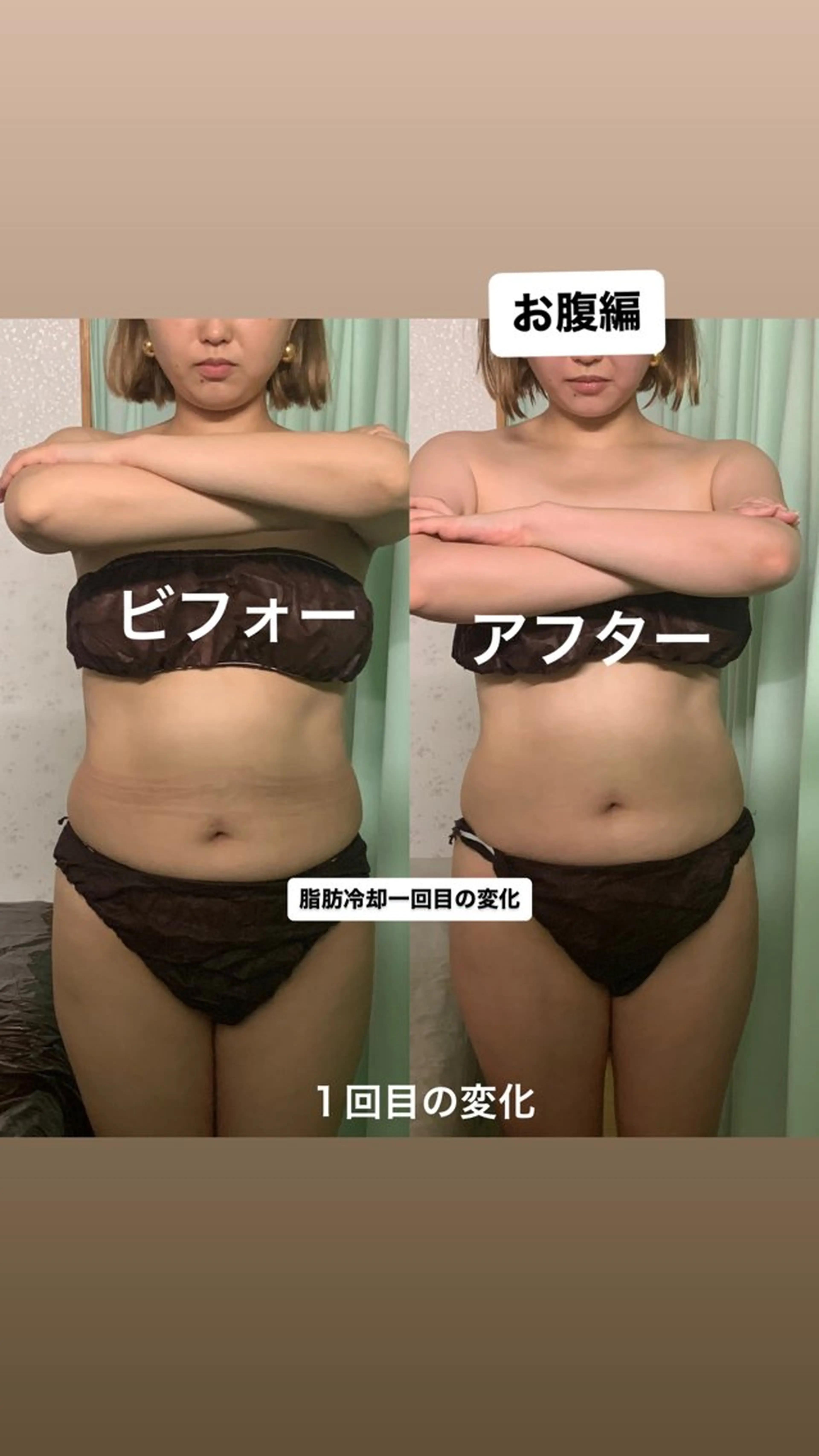 エステ リラク 【ハイパーナイフ痩身&小顔コルギ&ハーブピーリング】K-Beauty　東新宿所属・kーbeauty小顔 コルギ&インディバのエステ・リラクイメージ