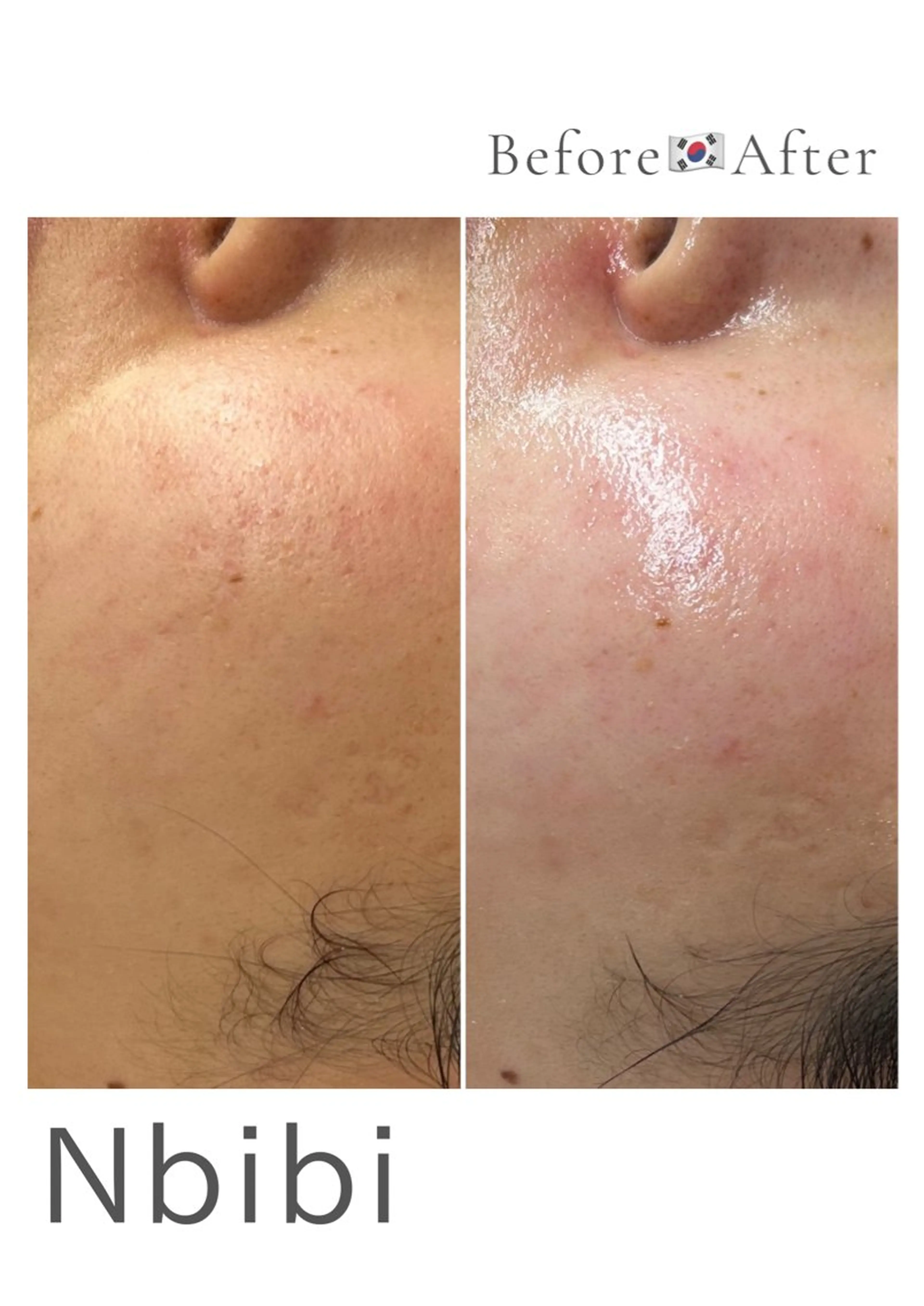 エステ 韓国🇰🇷価格 サロン_Nbibiのエステ・リラクイメージ