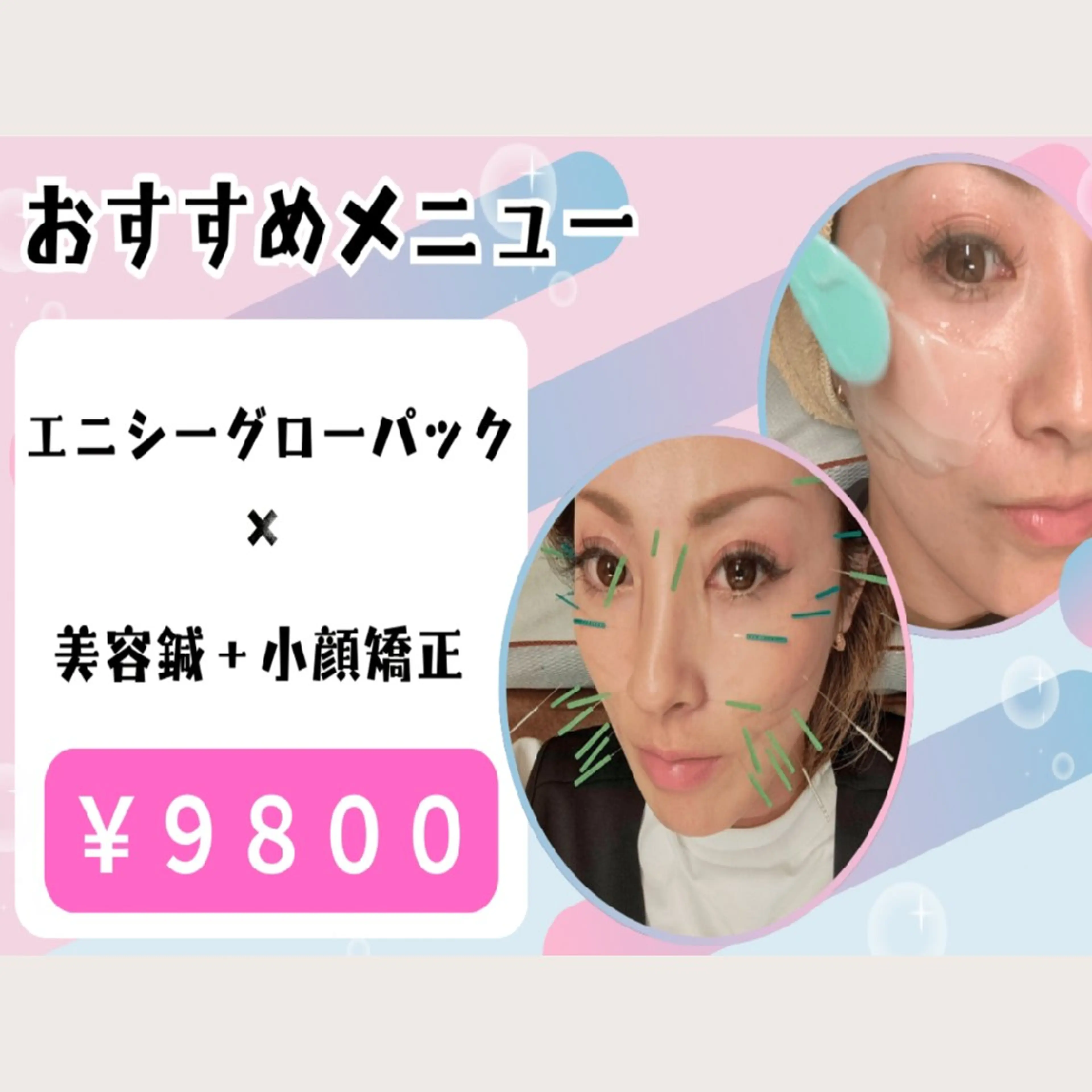 エステ リラク 頭痛・腰痛・美容鍼に 特化してます。　橋岡のエステ・リラクイメージ