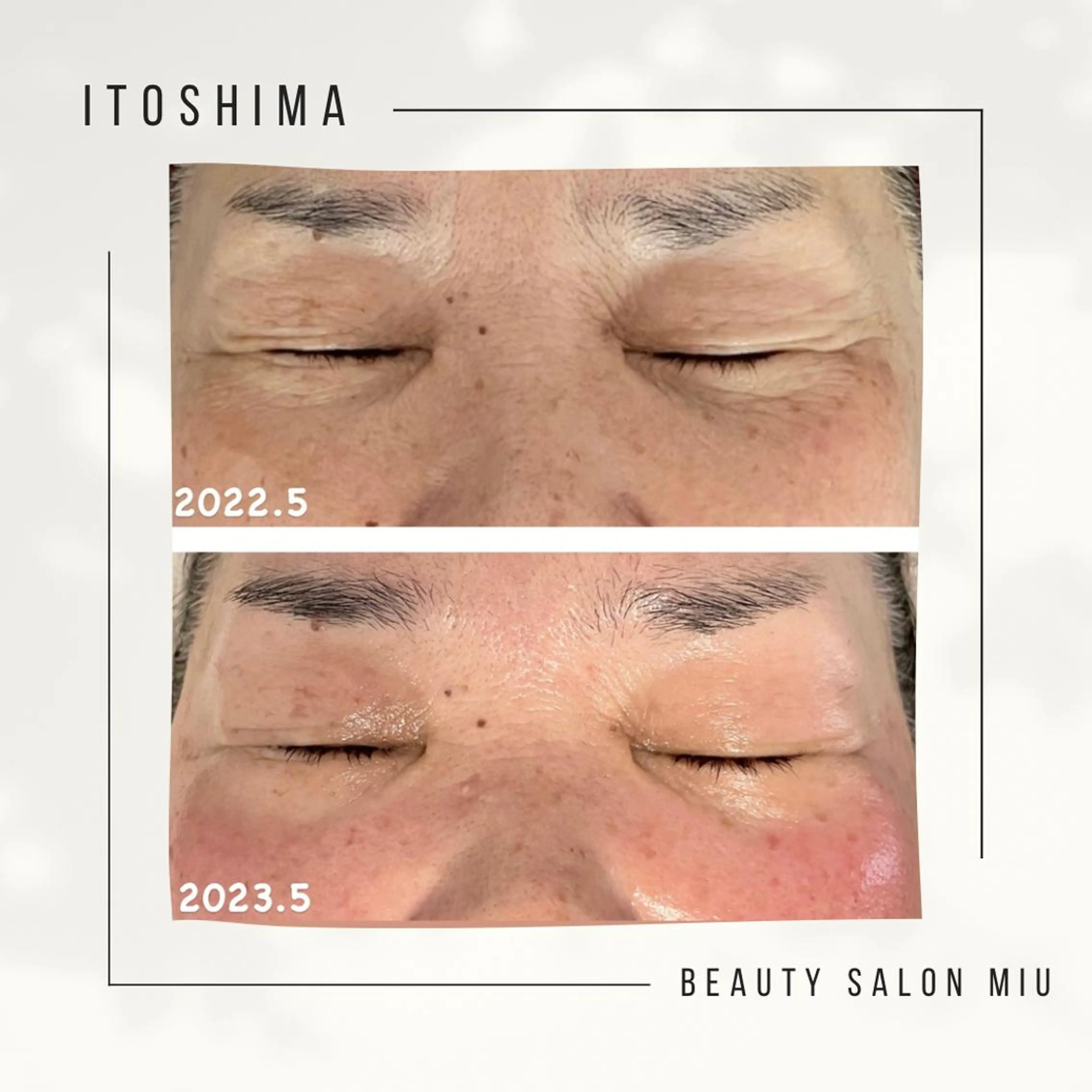 エステ 糸島 エステサロンmiuのエステ・リラクイメージ