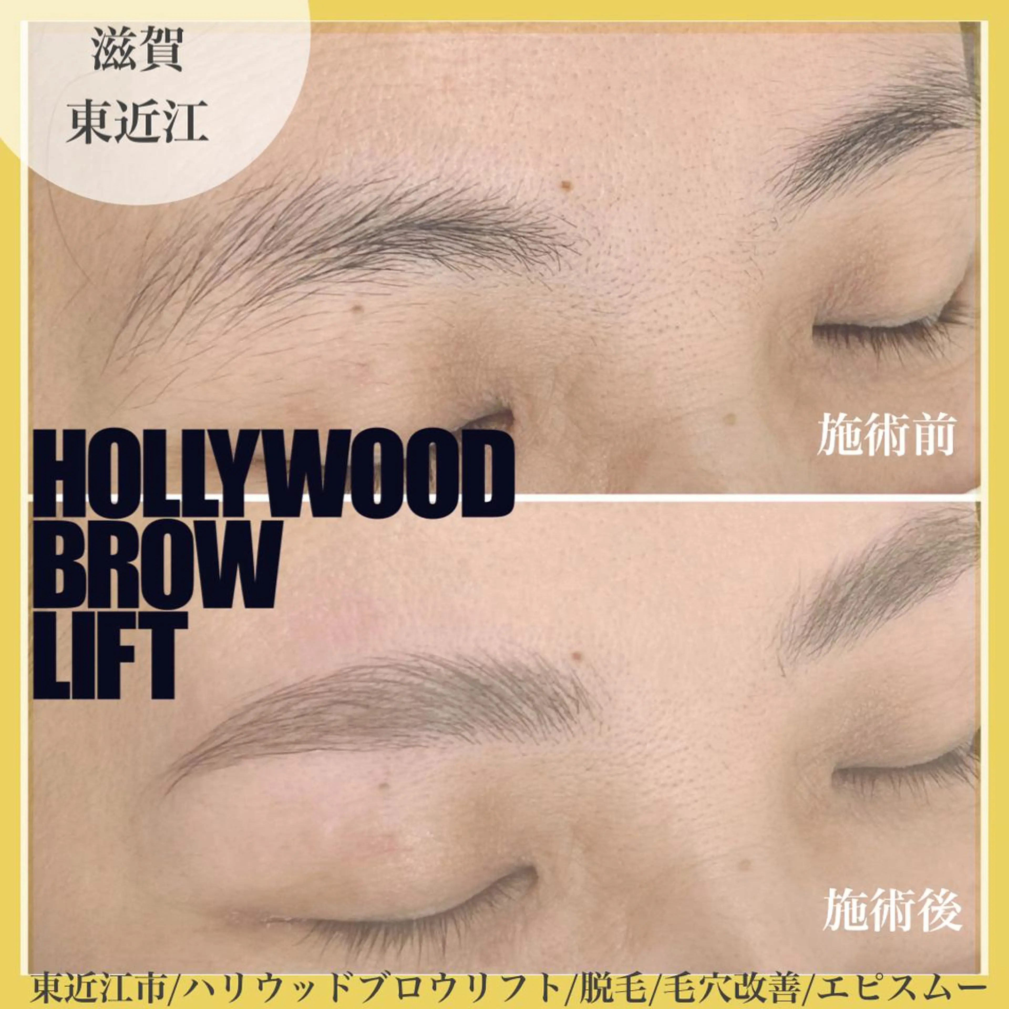 アイブロウ その他(アイブロウ) epismoo 脱毛/HBL/毛穴の眉毛・アイブロウイメージ