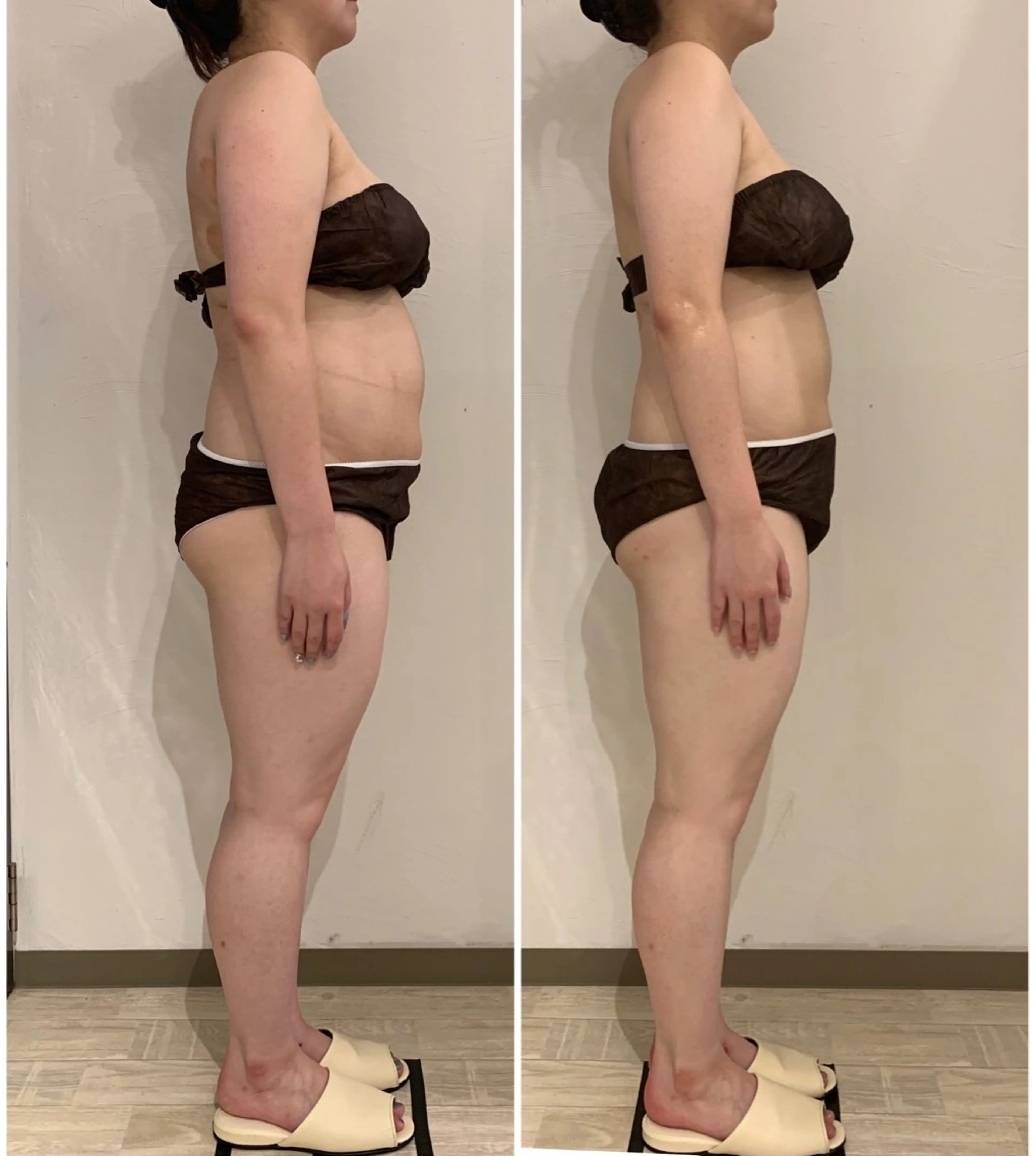 エステ リラク リンパマッサージ&ピラティスmimoza所属・リンパマッサージ mimozaのエステ・リラクイメージ