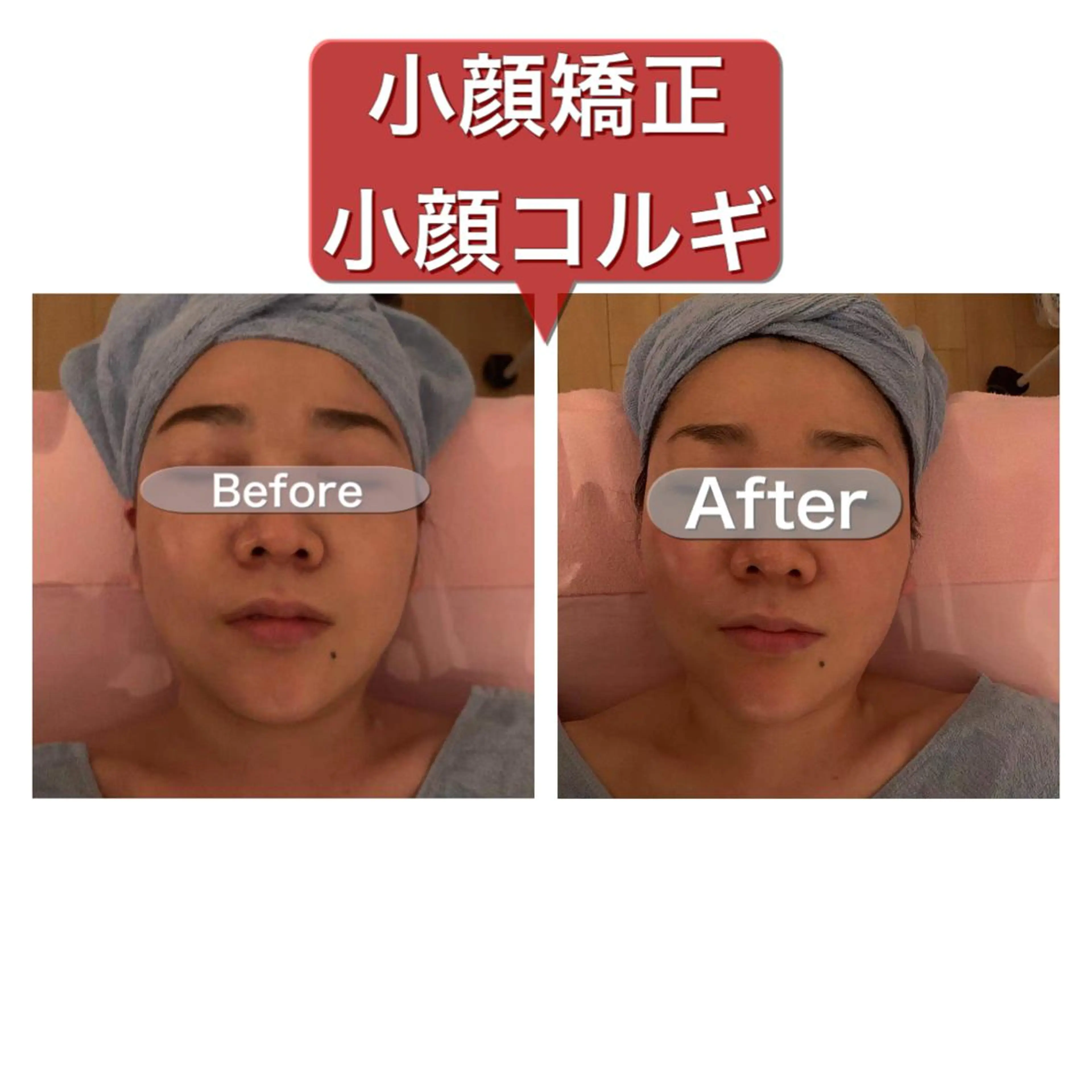 【ハイパーナイフ痩身&小顔コルギ&ハーブピーリング】K-Beauty　東新宿所属・kーbeauty痩身 フェイシャルのエステ・リラクイメージ