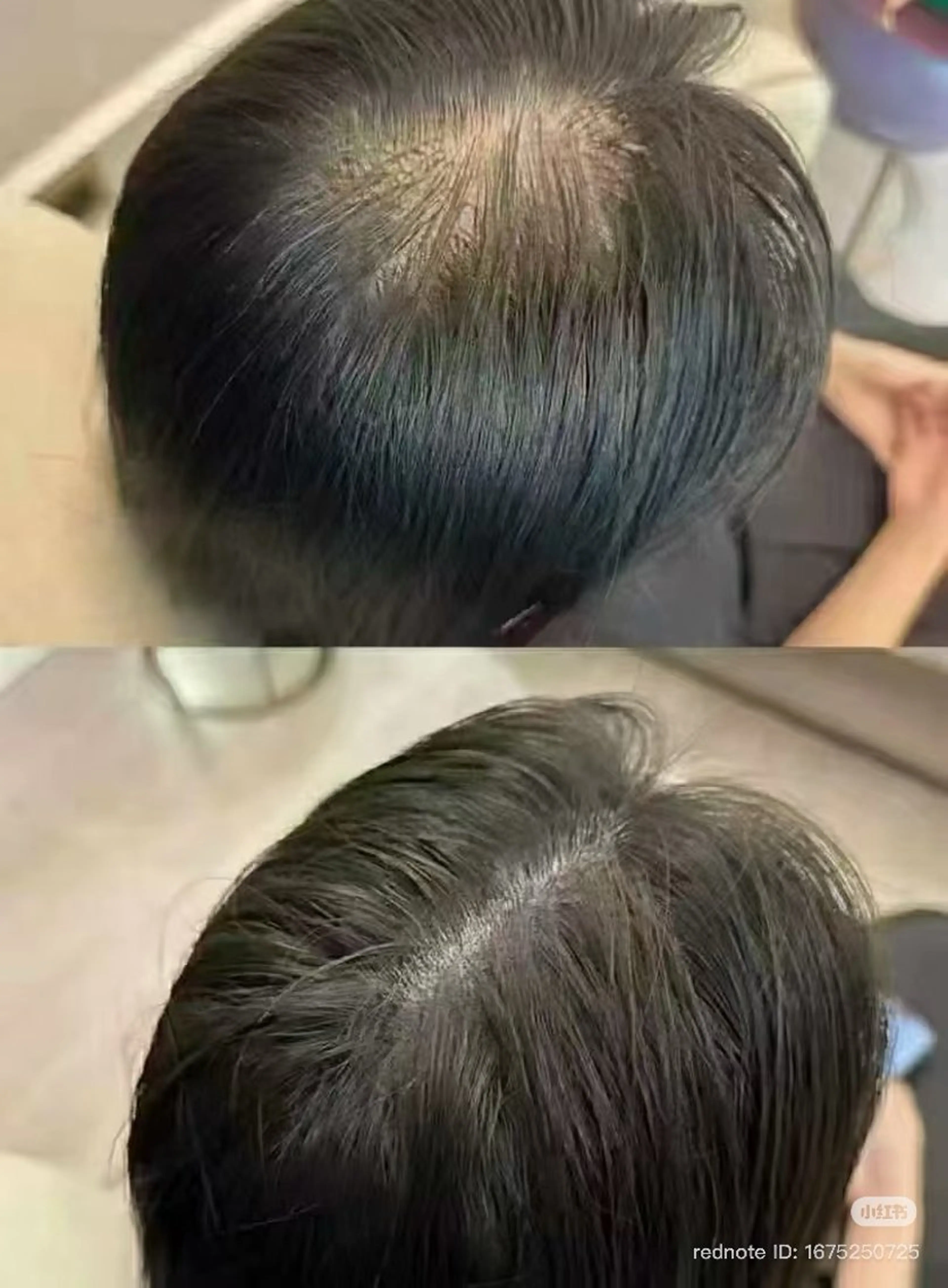 增毛エクステ200本(前髪　頭頂　など気になる場所)の写真
